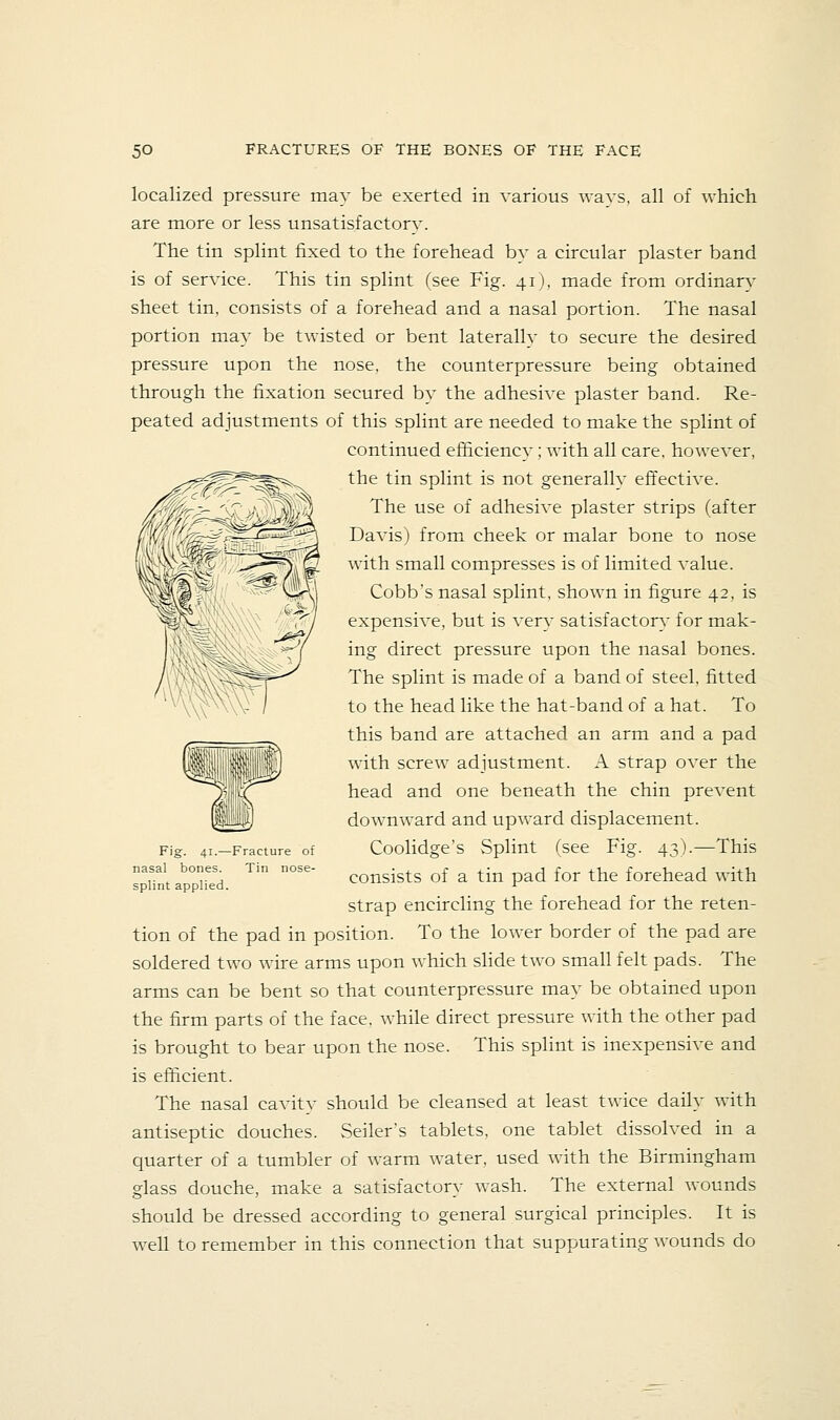 localized pressure may be exerted in various wavs, all of which are more or less unsatisfactorv. The tin splint fixed to the forehead by a circular plaster band is of service. This tin splint (see Fig. 41), made from ordinary sheet tin, consists of a forehead and a nasal portion. The nasal portion may be twisted or bent laterally to secure the desired pressure upon the nose, the counterpressure being obtained through the fixation secured by the adhesive plaster band. Re- peated adjustments of this splint are needed to make the splint of continued efliciencv ; with all care, however, the tin splint is not generally eft'ective. The use of adhesive plaster strips (after Davis) from cheek or malar bone to nose with small compresses is of limited value. Cobb's nasal splint, shown in figure 42, is expensive, but is very satisfactory for mak- ing direct pressure upon the nasal bones. The splint is made of a band of steel, fitted to the head like the hat-band of a hat. To this band are attached an arm and a pad with screw adjustment. A strap OA'er the head and one beneath the chin prevent downward and upward displacement. Coolidge's Splint (see Fig. 43).—This consists of a tin pad for the forehead with strap encircling the forehead for the reten- tion of the pad in position. To the lower border of the pad are soldered two wire arms upon which slide two small felt pads. The arms can be bent so that counterpressure may be obtained upon the firm parts of the face, while direct pressure with the other pad is brought to bear upon the nose. This splint is inexpensi^-e and is efficient. The nasal cavity should be cleansed at least twice daily with antiseptic douches. Seiler's tablets, one tablet dissolved in a quarter of a tumbler of warm water, used with the Birmingham glass douche, make a satisfactory wash. The external wounds should be dressed according to general surgical principles. It is well to remember in this connection that suppurating wounds do Fig. 41.—Fracture of nasal bones. Tin nose- splint applied.