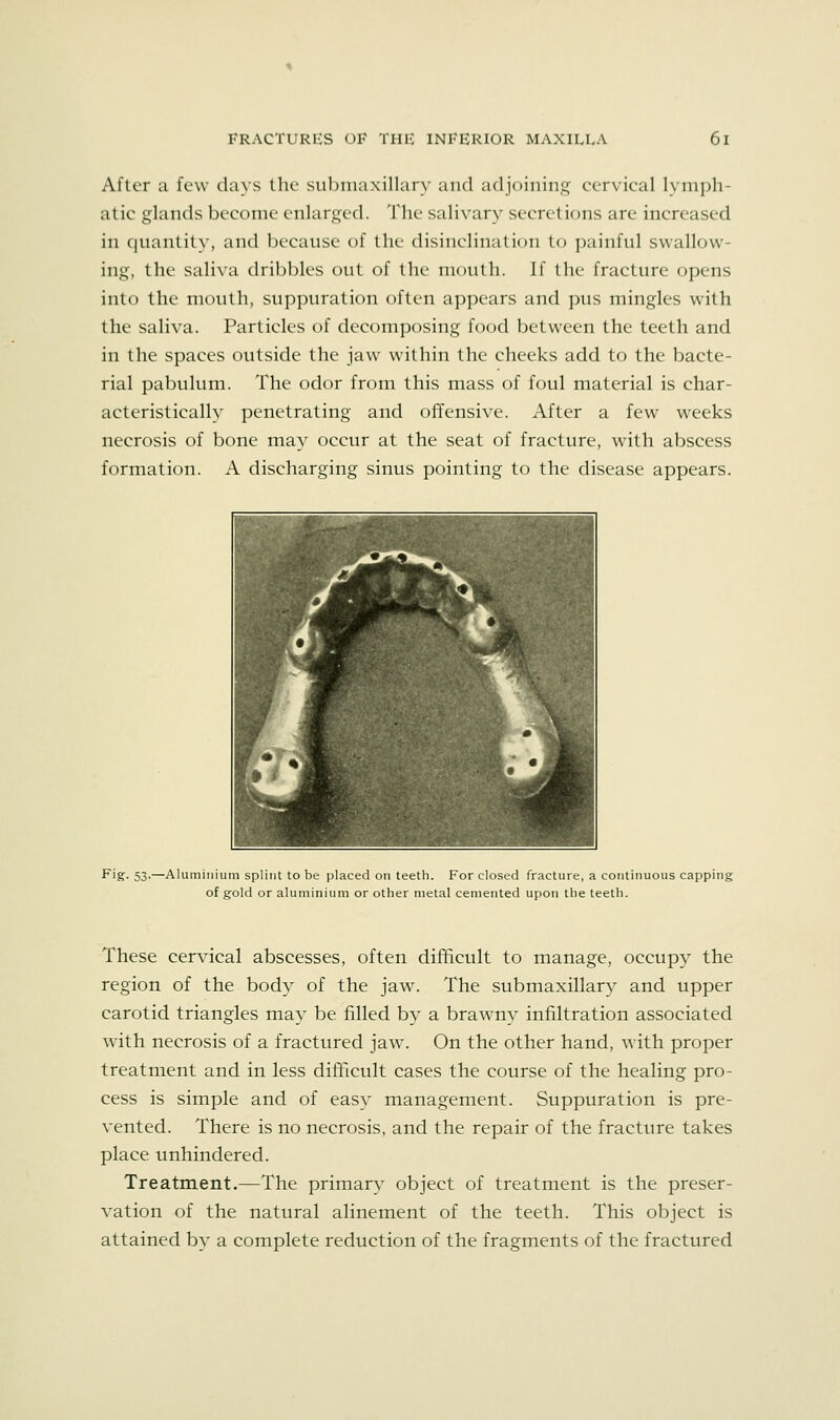 After a few days the submaxillary and adjoining cervical 1\ nipli- atic glands become enlarged. The salivary secretions are increased in quantity, and because of the disinclination to painful swallow- ing, the saliva dribbles out of the mouth. If the fracture opens into the mouth, suppuration often appears and pus mingles with the saliva. Particles of decomposing food between the teeth and in the spaces outside the jaw within the cheeks add to the bacte- rial pabulum. The odor from this mass of foul material is char- acteristically penetrating and offensive. After a few weeks necrosis of bone may occur at the seat of fracture, with abscess formation. A discharging sinus pointing to the disease appears. Fig. 53.—Aluminium splint to be placed on teeth. For closed fracture, a continuous capping of gold or aluminium or other metal cemented upon the teeth. These cervical abscesses, often diflficult to manage, occupy the region of the body of the jaw. The submaxillary and upper carotid triangles may be filled by a brawny infiltration associated with necrosis of a fractured jaw. On the other hand, with proper treatment and in less difficult cases the course of the healing pro- cess is simple and of easy management. Suppuration is pre- vented. There is no necrosis, and the repair of the fracture takes place unhindered. Treatment.—The primary object of treatment is the preser- vation of the natural alinement of the teeth. This object is attained by a complete reduction of the fragments of the fractured