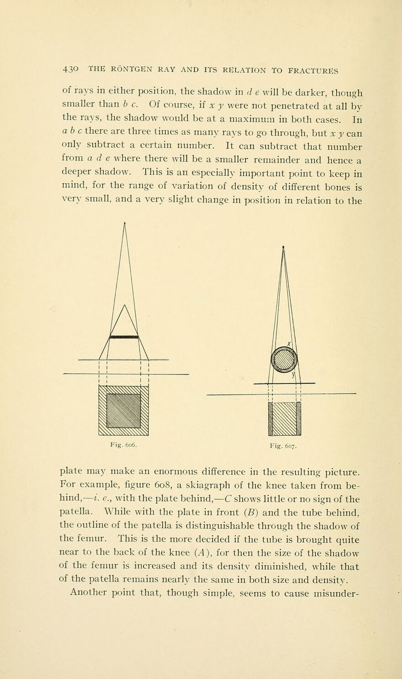 of rays in either position, the shadow in d e will be darker, though smaller than h c. Of course, if x y were not penetrated at all by the rays, the shadow would be at a maximum in both cases. In ah c there are three times as many rays to go through, but x y can only subtract a certain number. It can subtract that number from a d e where there will be a smaller remainder and hence a deeper shadow. This is an especially important point to keep in mind, for the range of variation of density of different bones is very small, and a very slight change in position in relation to the Fig. 606. Fig. 607. plate may make an enormous difference in the resulting picttu-e. For example, figure 608, a skiagraph of the knee taken from be- hind,—i. e., with the plate behind,—C shows little or no sign of the patella. While with the plate in front {B) and the tube behind, the outline of the patella is distinguishable through the shadow of the femur. This is the more decided if the tube is brought quite near to the back of the knee {A), for then the size of the shadow of the femur is increased and its density diminished, while that of the patella remains nearly the same in both size and density. Another point that, though simple, seems to cause misunder-