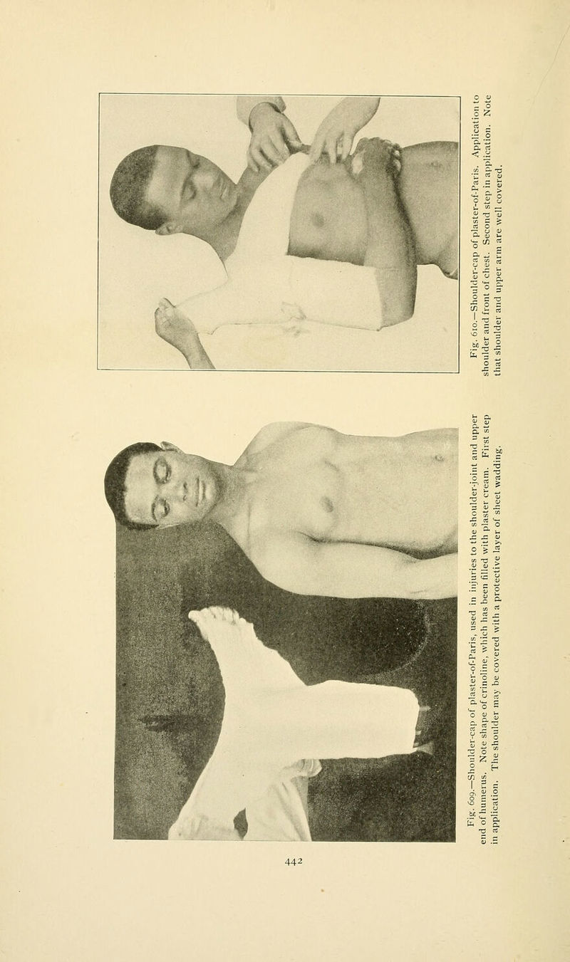 n -a p Cfl CS T) 1^ rt -a bb o Ix, rt ^