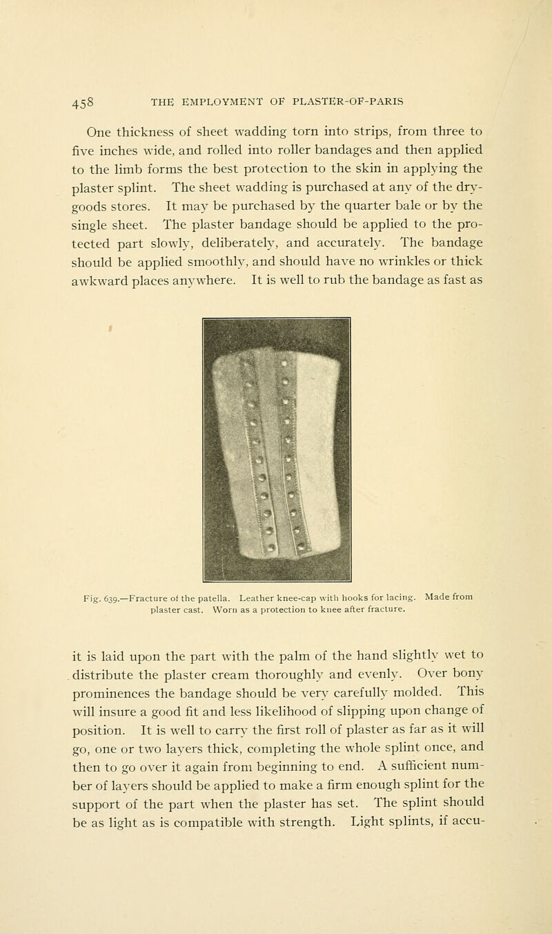 One thickness of sheet wadding torn into strips, from three to five inches wide, and rolled into roller bandages and then applied to the limb forms the best protection to the skin in applying the plaster splint. The sheet wadding is purchased at any of the dry- goods stores. It may be purchased by the quarter bale or by the single sheet. The plaster bandage should be applied to the pro- tected part slowly, deliberately, and accurately. The bandage should be applied smoothly, and should have no wrinkles or thick awkward places an^^where. It is well to rub the bandage as fast as Fig. 639.—Fracture of the patella. Leather knee-cap with hooks for lacing. Made from plaster cast. Worn as a protection to knee after fracture. it is laid upon the part with the palm of the hand slightly wet to distribute the plaster cream thoroughly and evenly. Over bony prominences the bandage should be very carefully molded. This will insure a good fit and less likelihood of slipping upon change of position. It is well to carry the first roll of plaster as far as it will go, one or two layers thick, completing the whole splint once, and then to go over it again from beginning to end. A sufficient num- ber of layers should be applied to make a firm enough splint for the support of the part when the plaster has set. The splint should be as light as is compatible with strength. Light splints, if accu-