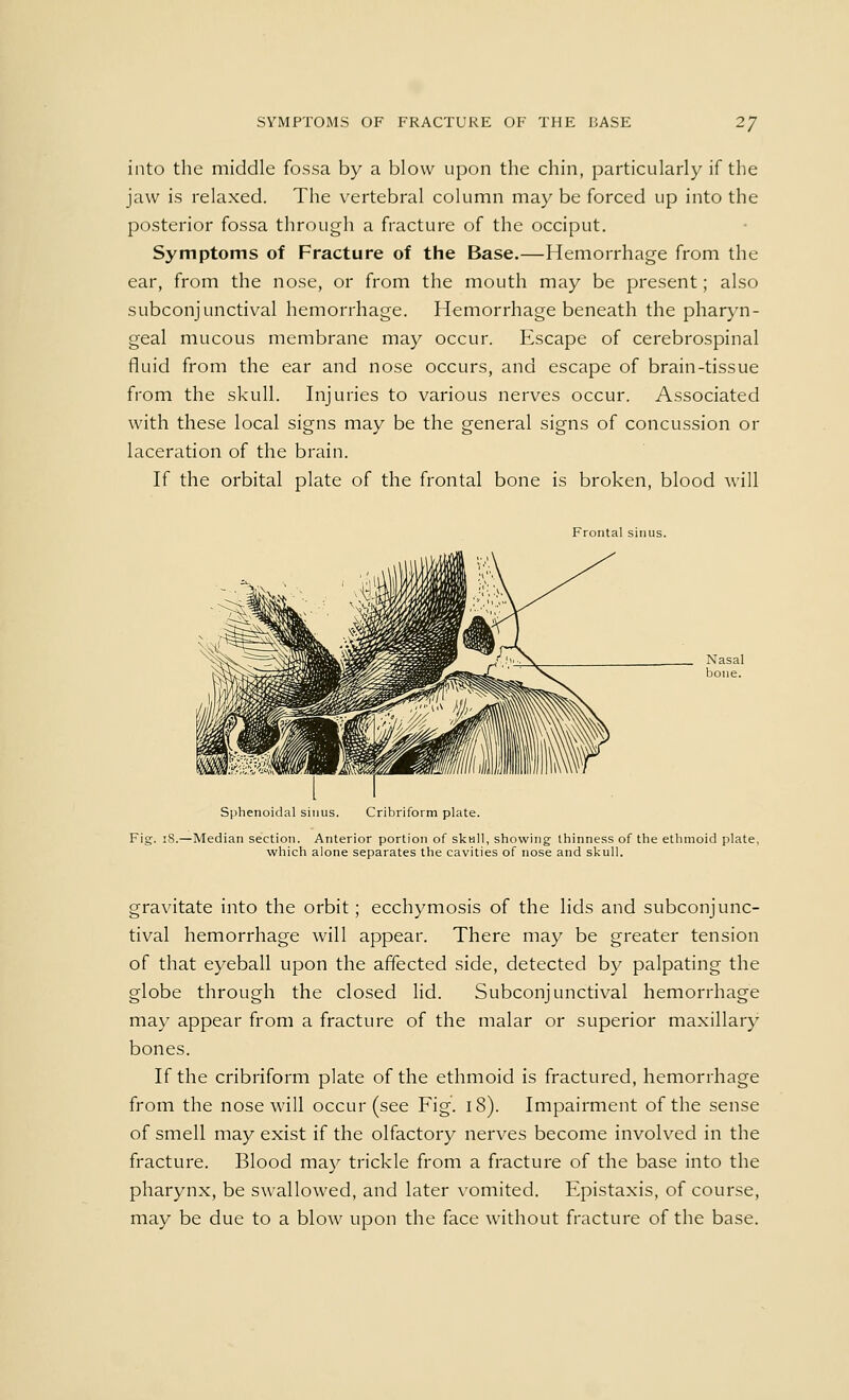 into the middle fossa by a blow upon the chin, particularly if the jaw is relaxed. The vertebral column may be forced up into the posterior fossa through a fracture of the occiput. Symptoms of Fracture of the Base.—Hemorrhage from the ear, from the nose, or from the mouth may be present; also subconjunctival hemorrhage. Hemorrhage beneath the pharyn- geal mucous membrane may occur. Escape of cerebrospinal fluid from the ear and nose occurs, and escape of brain-tissue from the skull. Injuries to various nerves occur. Associated with these local signs may be the general signs of concussion or laceration of the brain. If the orbital plate of the frontal bone is broken, blood will Frontal sinus. Sphenoidal sinus. Cribriform plate. Fig. 18.—Median section. Anterior portion of skull, showing thinness of the ethmoid plate, which alone separates the cavities of nose and skull. gravitate into the orbit; ecchymosis of the lids and subconjunc- tival hemorrhage will appear. There may be greater tension of that eyeball upon the affected side, detected by palpating the globe through the closed lid. Subconjunctival hemorrhage may appear from a fracture of the malar or superior maxillary bones. If the cribriform plate of the ethmoid is fractured, hemorrhage from the nose will occur (see Fig. 18). Impairment of the sense of smell may exist if the olfactory nerves become involved in the fracture. Blood may trickle from a fracture of the base into the pharynx, be swallowed, and later vomited. Epistaxis, of course, may be due to a blow upon the face without fracture of the base.