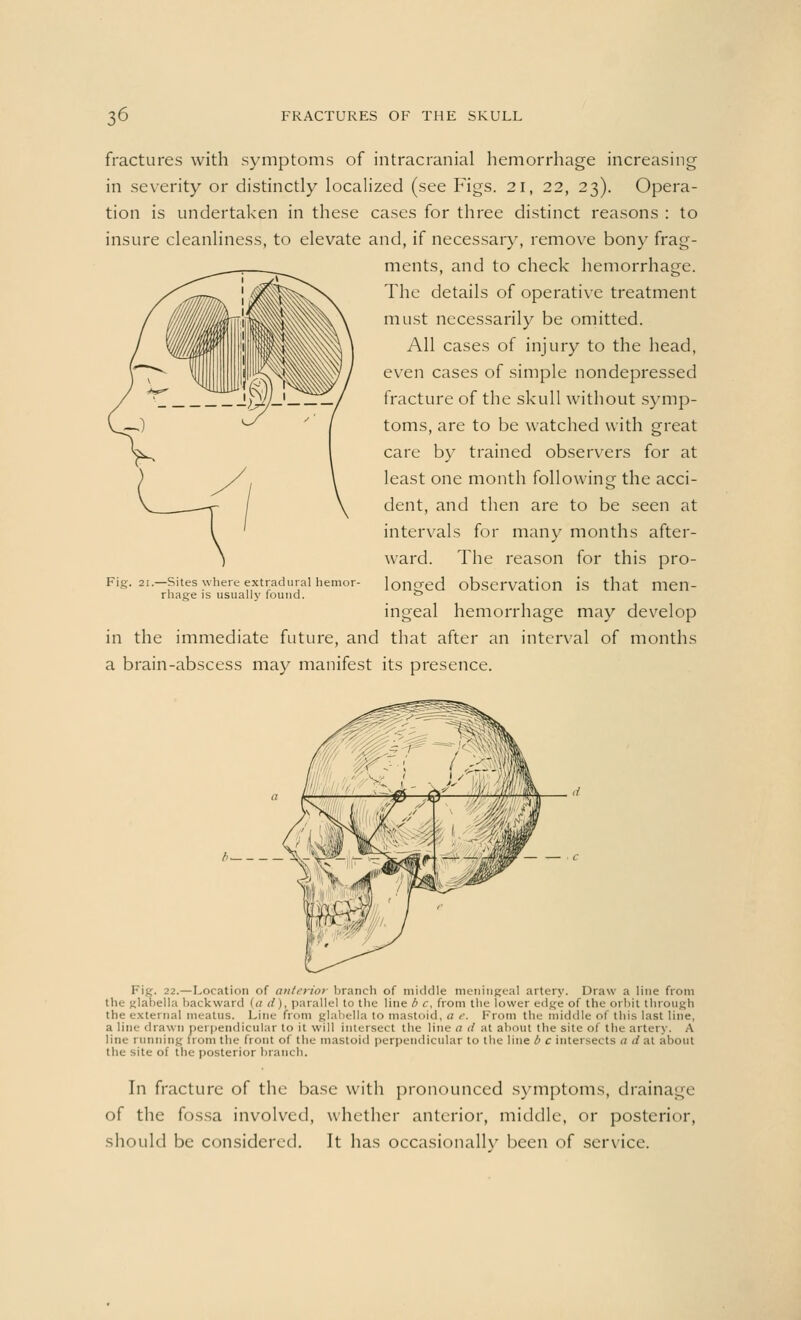 fractures with symptoms of intracranial hemorrhage increasing in severity or distinctly localized (see Figs. 21, 22, 23). Opera- tion is undertaken in these cases for three distinct reasons : to insure cleanliness, to elevate and, if necessary, remove bony frag- ments, and to check hemorrhage. The details of operative treatment must necessarily be omitted. All cases of injury to the head, even cases of simple nondepressed fracture of the skull without symp- toms, are to be watched with great care by trained observers for at least one month following the acci- dent, and then are to be seen at intervals for many months after- ward. The reason for this pro- longed observation is that men- ingeal hemorrhage may develop in the immediate future, and that after an interval of months a brain-abscess may manifest its presence. Fig. 21.—Sites where extradural hemor- rhage is usually found. Fie. 22.—Location of anterior branch of middle meningeal artery. Draw a line from idla backward [a d), parallel to the line b c. from the lower edge of the orbit through the external meatus. Line from glabella to mastoid, a r. From the middle of this last line, a line drawn perpendicular to it will intersect the line a ti at about the site of the artery. A line running from the front of the mastoid perpendicular to the line b c intersects a d at about the site of the posterior branch. In fracture of the base with pronounced symptoms, drainage of the fossa involved, whether anterior, middle, or posterior, should be considered. It has occasionally been of service.