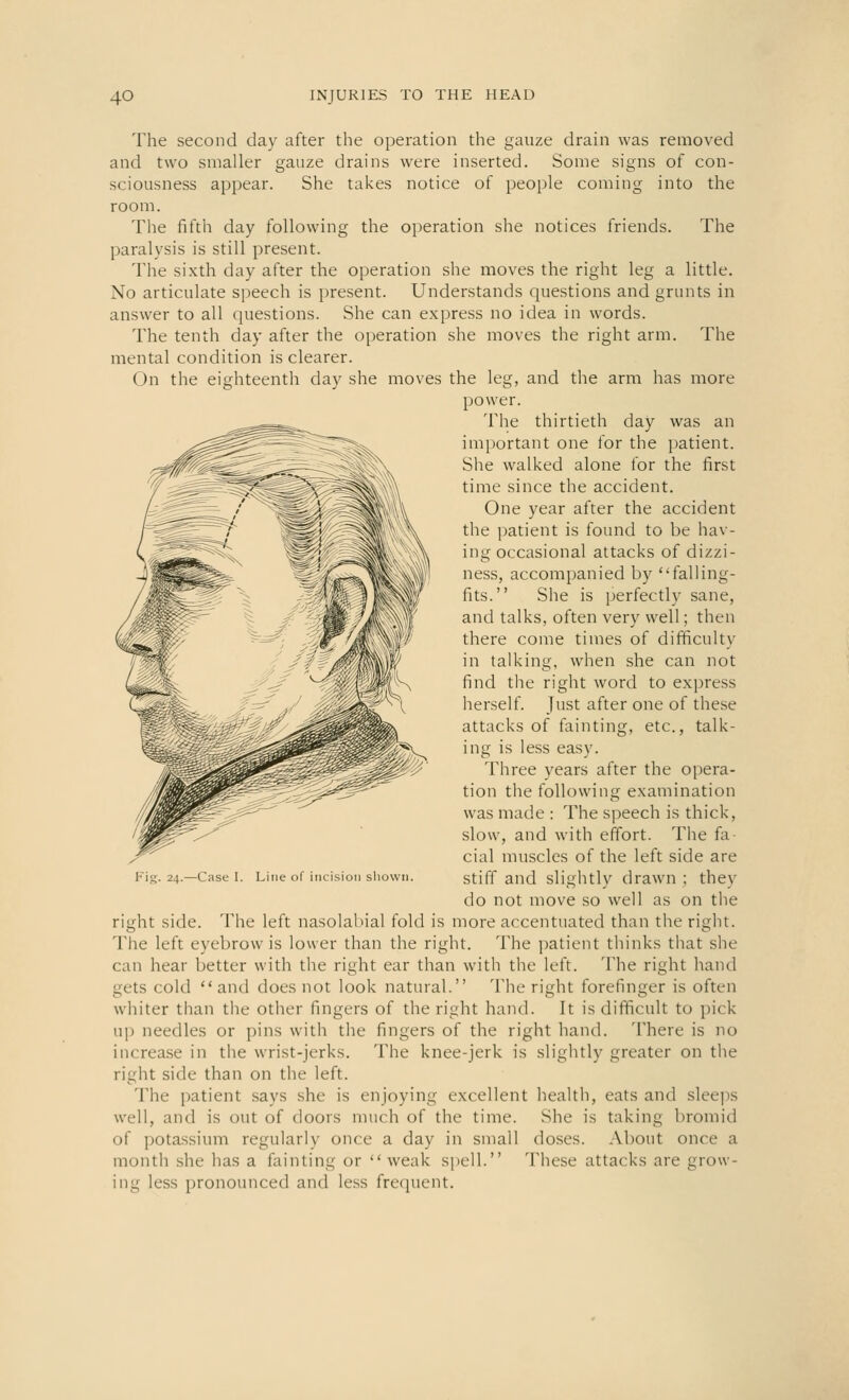 The second day after the operation the gauze drain was removed and two smaller gauze drains were inserted. Some signs of con- sciousness appear. She takes notice of people coming into the room. The fifth day following the operation she notices friends. The paralysis is still present. The sixth day after the operation she moves the right leg a little. No articulate speech is present. Understands questions and grunts in answer to all questions. She can express no idea in words. The tenth day after the operation she moves the right arm. The mental condition is clearer. On the eighteenth day she moves the leg, and the arm has more power. The thirtieth day was an important one for the patient. She walked alone for the first time since the accident. One year after the accident the patient is found to be hav- ing occasional attacks of dizzi- ness, accompanied by falling- fits. She is perfectly sane, and talks, often very well; then there come times of difficulty in talking, when she can not find the right word to express herself. Just after one of these attacks of fainting, etc., talk- ing is less easy. Three years after the opera- tion the following examination was made : The speech is thick, slow, and with effort. The fa cial muscles of the left side are stiff and slightly drawn ; they do not move so well as on the right side. The left nasolabial fold is more accentuated than the right. The left eyebrow is lower than the right. The patient thinks that she can hear better with the right ear than with the left. The right hand gets cold and does not look natural. The right forefinger is often whiter than the other fingers of the right hand. It is difficult to pick up needles or pins with the fingers of the right hand. There is no increase in the wrist-jerks. The knee-jerk is slightly greater on the right side than on the left. The patient says she is enjoying excellent health, eats and sleeps well, and is out of doors much of the time. She is taking bromid of potassium regularly once a day in small doses. About once a month she has a fainting or  weak spell. These attacks are grow- ing less pronounced and less frequent. Fig. 24.—Case I. Line of incision shown.