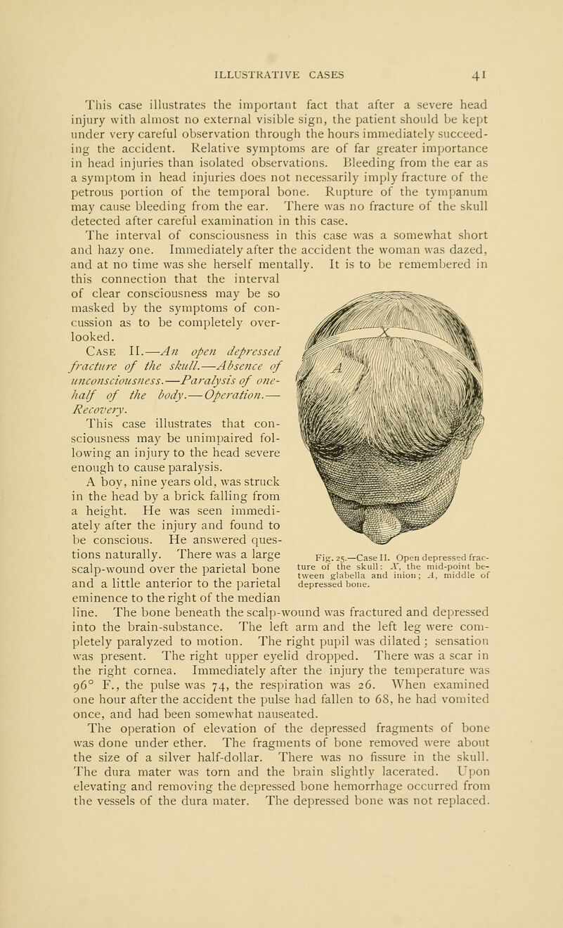 This case illustrates the important fact that after a severe head injury with almost no external visible sign, the patient should be kept under very careful observation through the hours immediately succeed- ing the accident. Relative symptoms are of far greater importance in head injuries than isolated observations. Bleeding from the ear as a symptom in head injuries does not necessarily imply fracture of the petrous portion of the temporal bone. Rupture of the tympanum may cause bleeding from the ear. There was no fracture of the skull detected after careful examination in this case. The interval of consciousness in this case was a somewhat short and hazy one. Immediately after the accident the woman was dazed, and at no time was she herself mentally. It is to be remembered in this connection that the interval of clear consciousness may be so masked by the symptoms of con- cussion as to be completely over- looked. Case II.—An open depressed fracture of the skull.—Absence of unconsciousness.—Paralysis of one- half of the body. — Operation.— Recovery. This case illustrates that con- sciousness may be unimpaired fol- lowing an injury to the head severe enough to cause paralysis. A boy, nine years old, was struck in the head by a brick falling from a height. He was seen immedi- ately after the injury and found to be conscious. He answered ques- tions naturally. There was a large scalp-wound over the parietal bone and a little anterior to the parietal eminence to the right of the median line. The bone beneath the scalp-wound was fractured and depressed into the brain-substance. The left arm and the left leg were com- pletely paralyzed to motion. The right pupil was dilated ; sensation was present. The right upper eyelid dropped. There was a scar in the right cornea. Immediately after the injury the temperature was 960 F., the pulse was 74, the respiration was 26. When examined one hour after the accident the pulse had fallen to 68, he had vomited once, and had been somewhat nauseated. The operation of elevation of the depressed fragments of bone was done under ether. The fragments of bone removed were about the size of a silver half-dollar. There was no fissure in the skull. The dura mater was torn and the brain slightly lacerated. Upon elevating and removing the depressed bone hemorrhage occurred from the vessels of the dura mater. The depressed bone was not replaced. Fig. 25.—Case II. Open depressed frac- ture of the skull: A, the mid-point be- tween glabella and inion; A, middle of depressed bone.