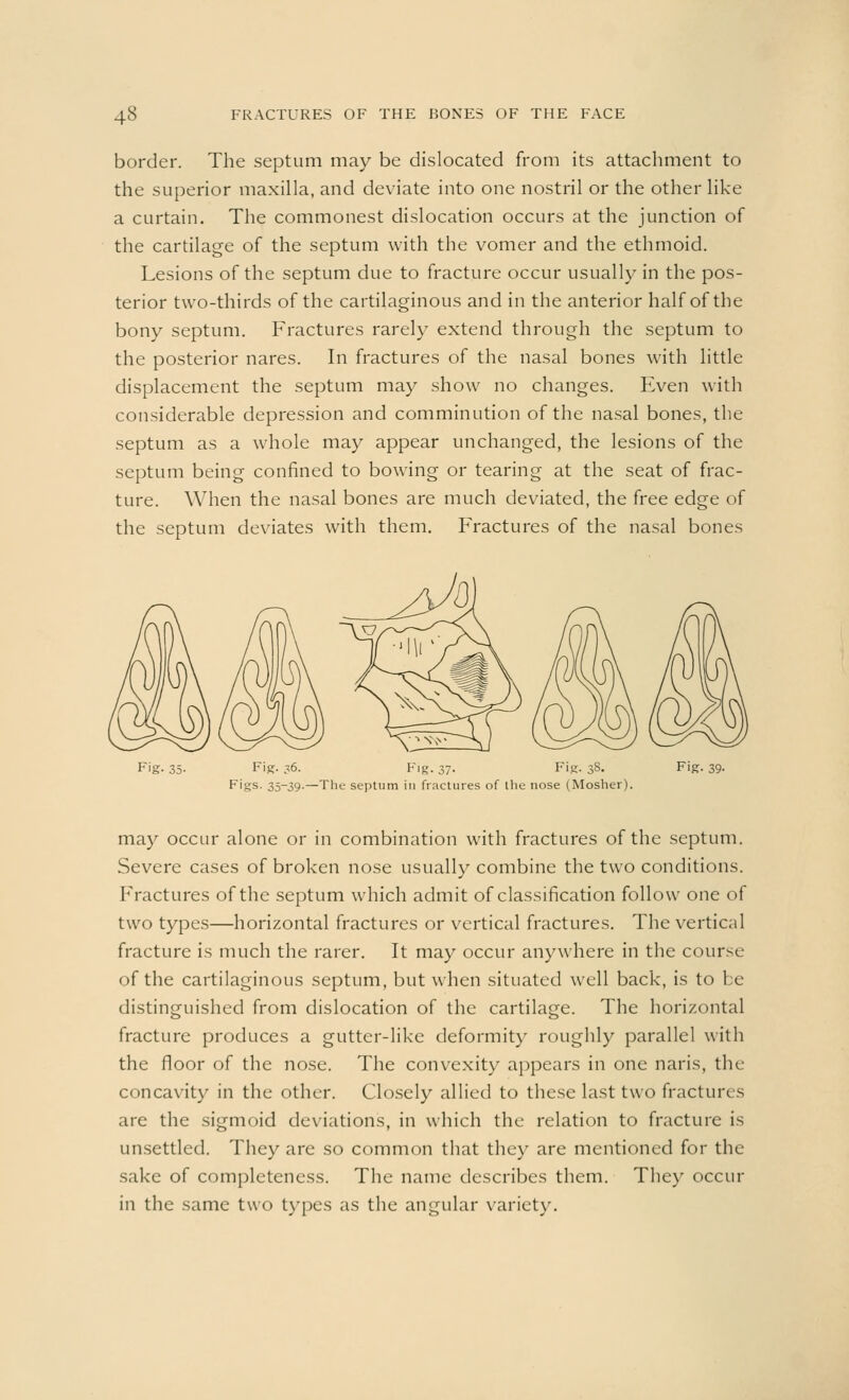 border. The septum may be dislocated from its attachment to the superior maxilla, and deviate into one nostril or the other like a curtain. The commonest dislocation occurs at the junction of the cartilage of the septum with the vomer and the ethmoid. Lesions of the septum due to fracture occur usually in the pos- terior two-thirds of the cartilaginous and in the anterior half of the bony septum. Fractures rarely extend through the septum to the posterior nares. In fractures of the nasal bones with little displacement the septum may show no changes. Even with considerable depression and comminution of the nasal bones, the septum as a whole may appear unchanged, the lesions of the septum being confined to bowing or tearing at the seat of frac- ture. When the nasal bones are much deviated, the free edge of the septum deviates with them. Fractures of the nasal bones Fig. 35- F'K- 36. Fig. 37. Fig. 3S. Fij Figs. 35-39.—The septum in fractures of the nose (Mosher). may occur alone or in combination with fractures of the septum. Severe cases of broken nose usually combine the two conditions. Fractures of the septum which admit of classification follow one of two types—horizontal fractures or vertical fractures. The vertical fracture is much the rarer. It may occur anywhere in the course of the cartilaginous septum, but when situated well back, is to be distinguished from dislocation of the cartilage. The horizontal fracture produces a gutter-like deformity roughly parallel with the floor of the nose. The convexity appears in one naris, the concavity in the other. Closely allied to these last two fractures are the sigmoid deviations, in which the relation to fracture is unsettled. They are so common that the)' are mentioned for the sake of completeness. The name describes them. They occur in the same two types as the angular variety.