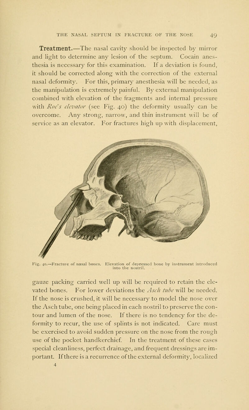 Treatment.—The nasal cavity should be inspected by mirror and light to determine any lesion of the septum. Cocain anes- thesia is necessary for this examination. If a deviation is found, it should be corrected along with the correction of the external nasal deformity. For this, primary anesthesia will be needed, as the manipulation is extremely painful. By external manipulation combined with elevation of the fragments and internal pressure with Roe's elevator (see Fig. 40) the deformity usually can be overcome. Any strong, narrow, and thin instrument will be of service as an elevator. For fractures high up with displacement, Fig. 40.—Fracture of nasal bones. Elevation of depressed bone by instrument introduced into the nostril. gauze packing carried well up will be required to retain the ele- vated bones. For lower deviations the Asch tube will be needed. If the nose is crushed, it will be necessary to model the nose over the Asch tube, one being placed in each nostril to preserve the con- tour and lumen of the nose. If there is no tendency for the de- formity to recur, the use of splints is not indicated. Care must be exercised to avoid sudden pressure on the nose from the rough use of the pocket handkerchief. In the treatment of these cases special cleanliness, perfect drainage, and frequent dressings are im- portant. If there is a recurrence of the external deformity, localized 4