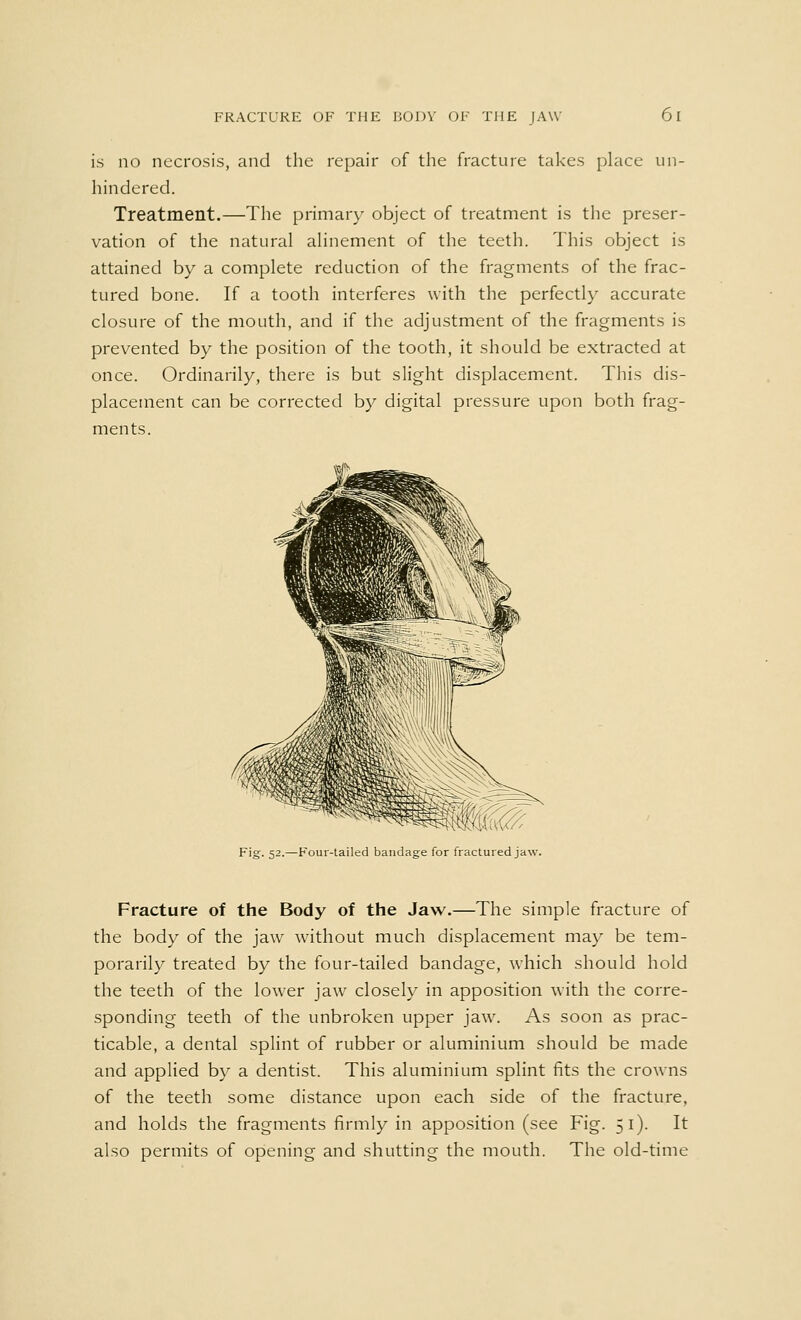 is no necrosis, and the repair of the fracture takes place un- hindered. Treatment.—The primary object of treatment is the preser- vation of the natural alinement of the teeth. This object is attained by a complete reduction of the fragments of the frac- tured bone. If a tooth interferes with the perfectly accurate closure of the mouth, and if the adjustment of the fragments is prevented by the position of the tooth, it should be extracted at once. Ordinarily, there is but slight displacement. This dis- placement can be corrected by digital pressure upon both frag- ments. Fig. 52.—Four-tailed bandage for fractured jaw. Fracture of the Body of the Jaw.—The simple fracture of the body of the jaw without much displacement may be tem- porarily treated by the four-tailed bandage, which should hold the teeth of the lower jaw closely in apposition with the corre- sponding teeth of the unbroken upper jaw. As soon as prac- ticable, a dental splint of rubber or aluminium should be made and applied by a dentist. This aluminium splint fits the crowns of the teeth some distance upon each side of the fracture, and holds the fragments firmly in apposition (see Fig. 51). It also permits of opening and shutting the mouth. The old-time