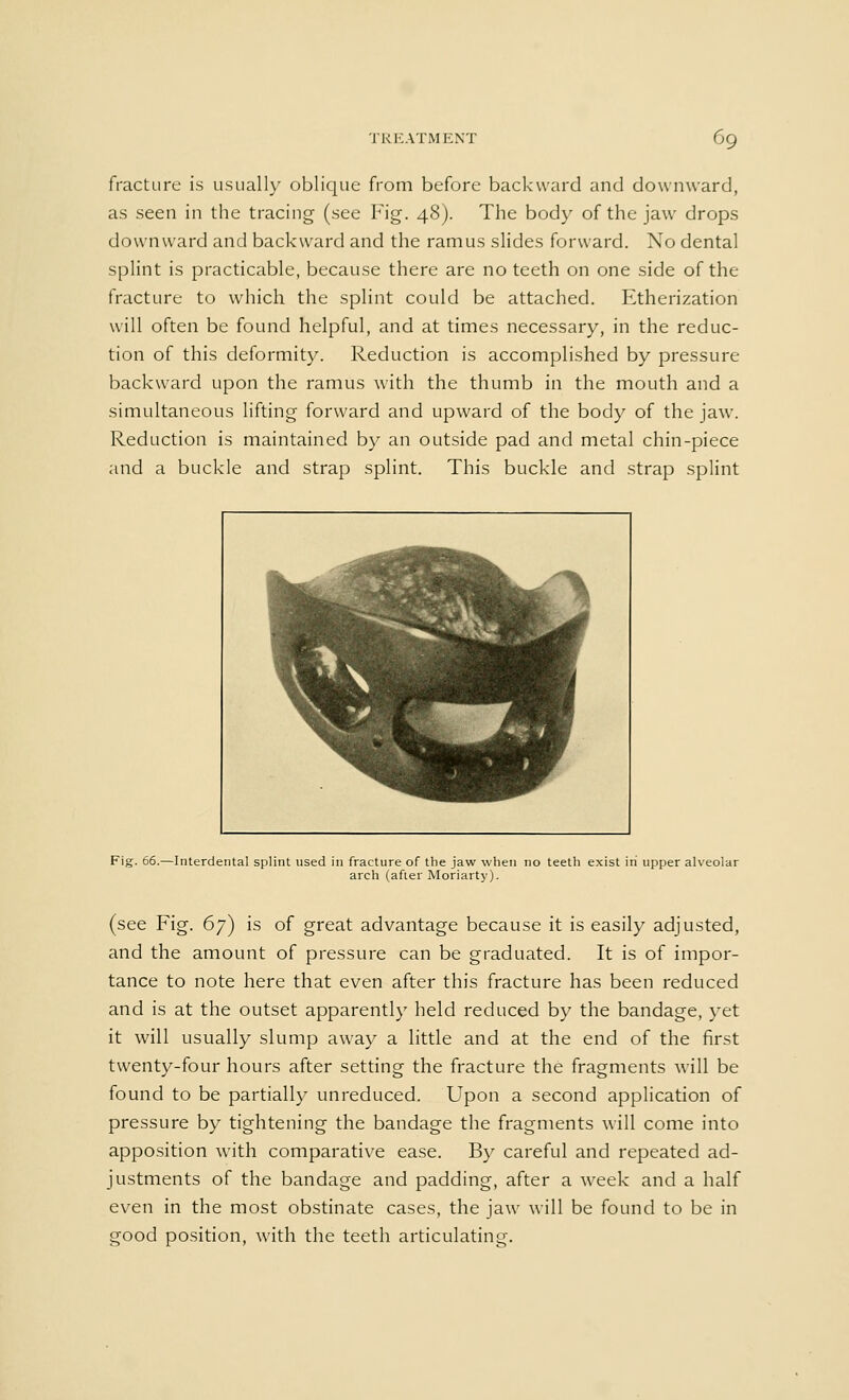 fracture is usually oblique from before backward and downward, as seen in the tracing (see Fig. 48). The body of the jaw drops downward and backward and the ramus slides forward. No dental splint is practicable, because there are no teeth on one side of the fracture to which the splint could be attached. Etherization will often be found helpful, and at times necessary, in the reduc- tion of this deformity. Reduction is accomplished by pressure backward upon the ramus with the thumb in the mouth and a simultaneous lifting forward and upward of the body of the jaw. Reduction is maintained by an outside pad and metal chin-piece and a buckle and strap splint. This buckle and strap splint 66.—Interdental splint used in fracture of the jaw when no teeth exist in upper alveolar arch (after Moriarty). (see Fig. 67) is of great advantage because it is easily adjusted, and the amount of pressure can be graduated. It is of impor- tance to note here that even after this fracture has been reduced and is at the outset apparently held reduced by the bandage, yet it will usually slump away a little and at the end of the first twenty-four hours after setting the fracture the fragments will be found to be partially unreduced. Upon a second application of pressure by tightening the bandage the fragments will come into apposition with comparative ease. By careful and repeated ad- justments of the bandage and padding, after a week and a half even in the most obstinate cases, the jaw will be found to be in good position, with the teeth articulating.