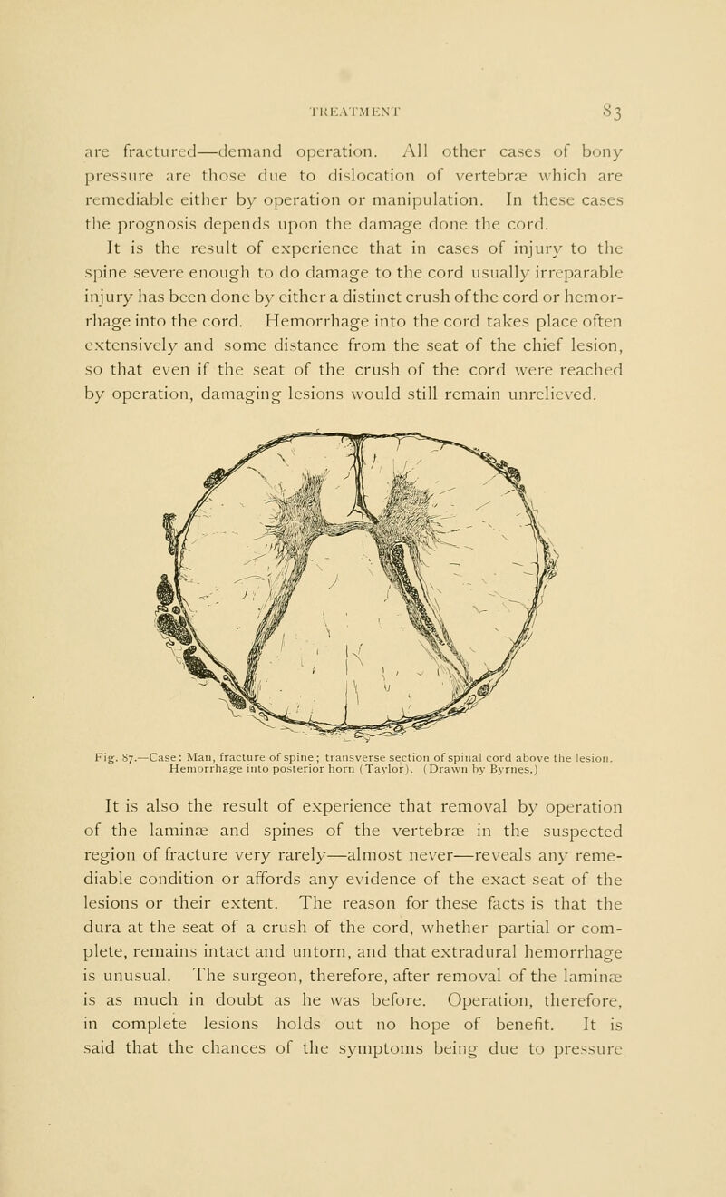 are fractured—demand operation. All other cases of bony pressure are those due to dislocation of vertebrae which are remediable either by operation or manipulation. In these cases the prognosis depends upon the damage done the cord. It is the result of experience that in cases of injury to the spine severe enough to do damage to the cord usually irreparable injury has been done by either a distinct crush of the cord or hemor- rhage into the cord. Hemorrhage into the cord takes place often extensively and some distance from the seat of the chief lesion, so that even if the seat of the crush of the cord were reached by operation, damaging lesions would still remain unrelieved. Fig. 87.—Case: Man, fracture of spine; transverse section of spinal cord above the lesion. Hemorrhage into posterior horn (Taylor). (Drawn by Byrnes.) It is also the result of experience that removal by operation of the laminae and spines of the vertebrae in the suspected region of fracture very rarely—almost never—reveals any reme- diable condition or affords any evidence of the exact seat of the lesions or their extent. The reason for these facts is that the dura at the seat of a crush of the cord, whether partial or com- plete, remains intact and untorn, and that extradural hemorrhage is unusual. The surgeon, therefore, after removal of the lamina' is as much in doubt as he was before. Operation, therefore, in complete lesions holds out no hope of benefit. It is said that the chances of the symptoms being due to pressure