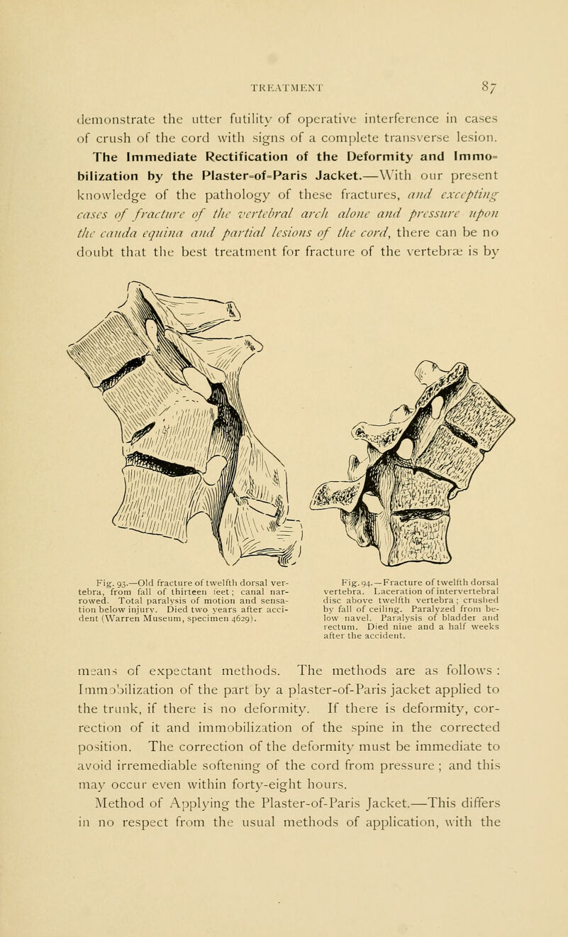 demonstrate the utter futility of operative interference in cases of crush of the cord with signs of a complete transverse lesion. The Immediate Rectification of the Deformity and Immo= bilization by the Plaster=of=Paris Jacket.—With our present knowledge of the pathology of these fractures, and excepting cases of fracture of the vertebral arch alone and pressure upon the can da equina and partial lesions of the cord, there can be no doubt that the best treatment for fracture of the vertebrae is by On Fig- 93-—Old fracture of twelfth dorsal ver- tebra, from fall of thirteen feet ; canal nar- rowed. Total paralysis of motion and sensa- tion below injury. Died two years after acci- dent (Warren Museum, specimen 4629). Fig. 94. — Fracture of twelfth dorsal vertebra. Laceration of intervertebral disc above twelfth vertebra ; crushed by fall of ceiling. Paralyzed from be- low navel. Paralysis of bladder and rectum. Died nine and a half weeks after the accident. means of expectant methods. The methods are as follows : Immobilization of the part by a plaster-of-Paris jacket applied to the trunk, if there is no deformity. If there is deformity, cor- rection of it and immobilization of the spine in the corrected position. The correction of the deformity must be immediate to avoid irremediable softening of the cord from pressure ; and this may occur even within forty-eight hours. Method of Applying the Plaster-of-Paris Jacket.—This differs in no respect from the usual methods of application, with the