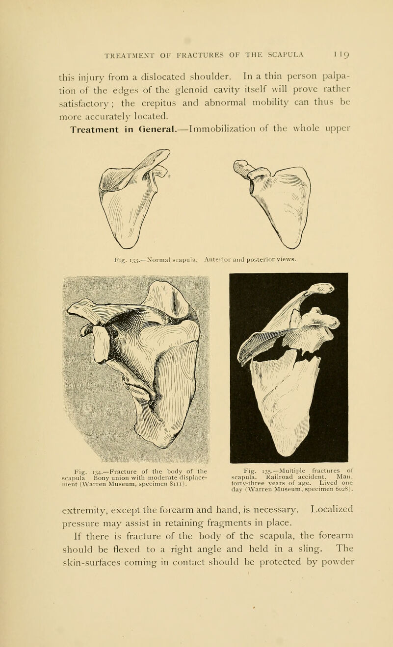 this injur\- from a dislocated shoulder. In a thin person palpa- tion of the edges of the glenoid cavity itself will prove rather satisfactory; the crepitus and abnormal mobility can thus In- more accurately located. Treatment in General.—Immobilization of the whole upper Fig. 133.—Normal scapula. Anterior and posterior views. Fig. 134.—Fracture of the body of the scapula Bony union with moderate displace- ment (Warren Museum, specimen 8111). Fig. 135.—Multiple fractures of scapula. Railroad accident. Man, forty-three years of age. Lived one day (Warren Museum, specimen 6028). extremity, except the forearm and hand, is necessary. Localized pressure may assist in retaining fragments in place. If there is fracture of the body of the scapula, the forearm should be flexed to a right angle and held in a sling. The skin-surfaces coming in contact should be protected by powder