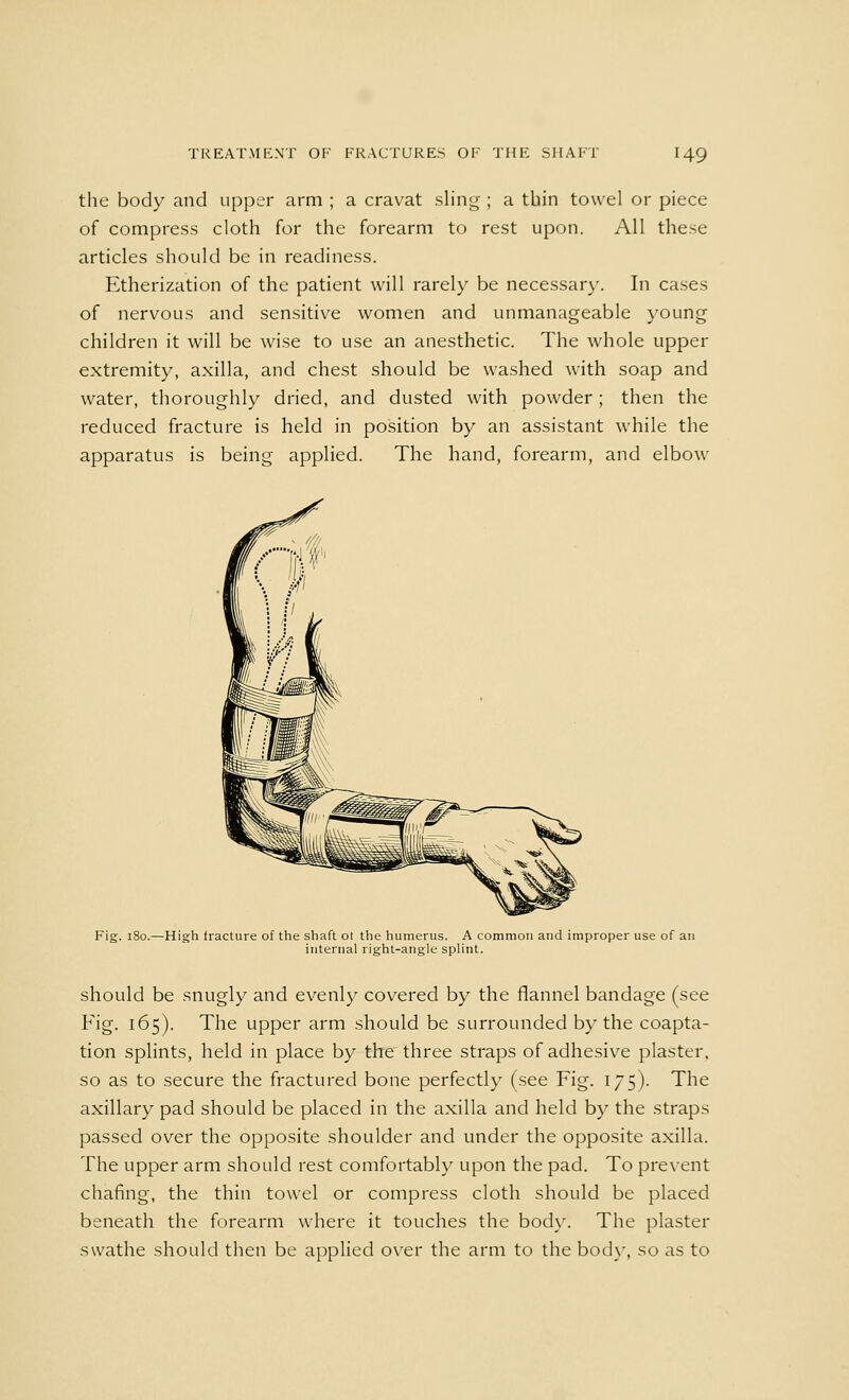 the body and upper arm ; a cravat sling ; a thin towel or piece of compress cloth for the forearm to rest upon. All these articles should be in readiness. Etherization of the patient will rarely be necessary. In cases of nervous and sensitive women and unmanageable young children it will be wise to use an anesthetic. The whole upper extremity, axilla, and chest should be washed with soap and water, thoroughly dried, and dusted with powder; then the reduced fracture is held in position by an assistant while the apparatus is being applied. The hand, forearm, and elbow Fig. 180.—High fracture of the shaft ot the humerus. A common and improper use of an internal right-angle splint. should be snugly and evenly covered by the flannel bandage (see Fig. 165). The upper arm should be surrounded by the coapta- tion splints, held in place by the three straps of adhesive plaster, so as to secure the fractured bone perfectly (see Fig. 175). The axillary pad should be placed in the axilla and held by the straps passed over the opposite shoulder and under the opposite axilla. The upper arm should rest comfortably upon the pad. To prevent chafing, the thin towel or compress cloth should be placed beneath the forearm where it touches the body. The plaster swathe should then be applied over the arm to the body, so as to