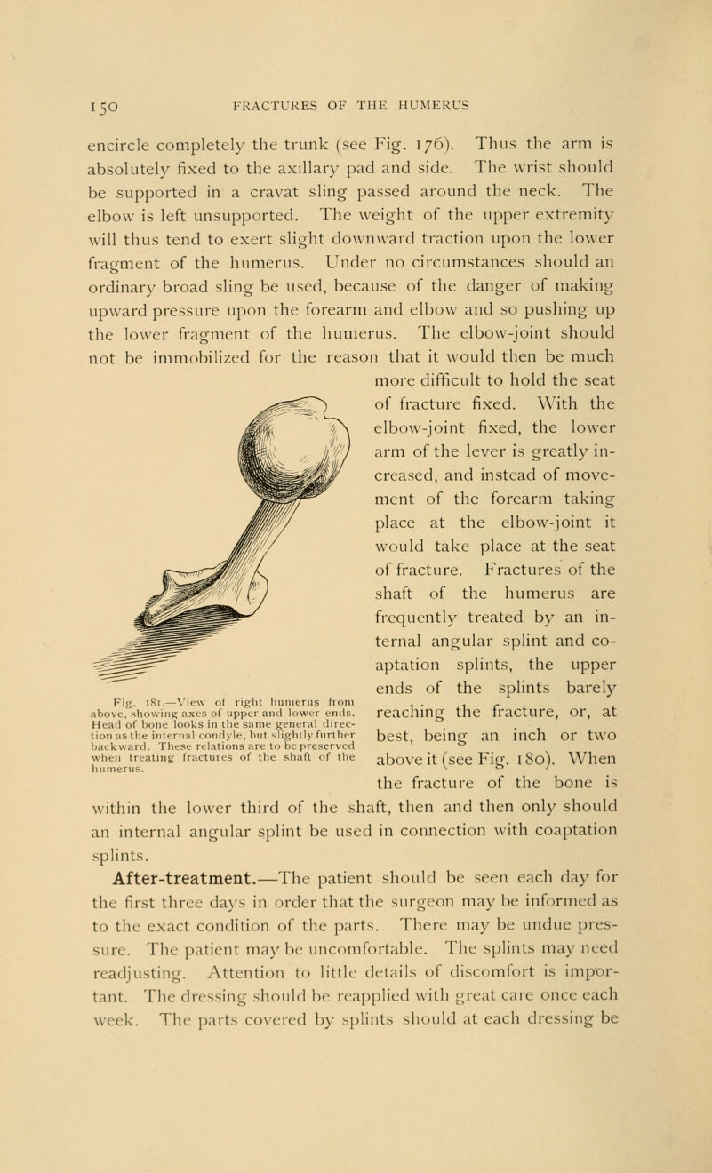 15° encircle completely the trunk (see Fig. 176). Thus the arm is absolutely fixed to the axillary pad and side. The wrist should be supported in a cravat sling passed around the neck. The elbow is left unsupported. The weight of the upper extremity will thus tend to exert slight downward traction upon the lower fragment of the humerus. Under no circumstances should an ordinary broad sling be used, because of the danger of making upward pressure upon the forearm and elbow and so pushing up the lower fragment of the humerus. The elbow-joint should not be immobilized for the reason that it would then be much more difficult to hold the seat of fracture fixed. With the elbow-joint fixed, the lower arm of the lever is greatly in- creased, and instead of move- ment of the forearm taking place at the elbow-joint it would take place at the seat of fracture. Fractures of the shaft of the humerus are frequently treated by an in- ternal angular splint and co- aptation splints, the upper ends of the splints barely reaching the fracture, or, at best, being an inch or two above it (see Fig. 180). When the fracture of the bone is within the lower third of the shaft, then and then only should an internal angular splint be used in connection with coaptation splints. After-treatment.—The patient should be seen each day for the first three days in order that the surgeon may be informed as to the exact condition of the parts. There may be undue pres- sure. The patient maybe uncomfortable. The splints may need readjusting. Attention to little details of discomfort is impor- tant. The dressing should be reapplied with great care once each week. The parts covered by splints should at each dressing be Fig. 181.—View of right humerus from above, showing axes of upper and lower ends. Head of bone looks in the same general direc- tion as the internal condyle, but slightly further backward. These relations are to be preserved when treating fractures of the shaft of the humerus.
