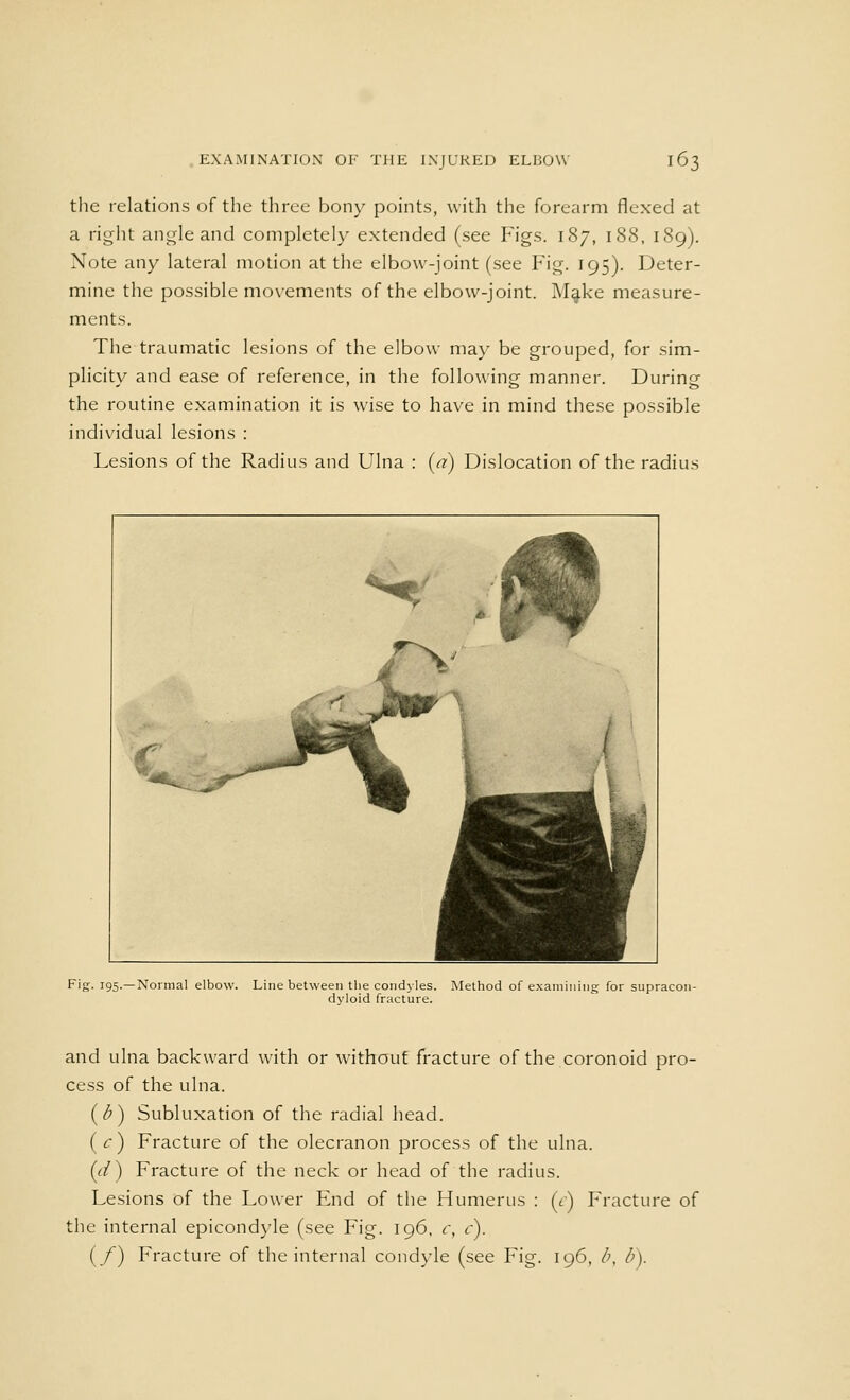 the relations of the three bony points, with the forearm flexed at a right angle and completely extended (see Figs. 187, 188, 189). Note any lateral motion at the elbow-joint (see Fig. 195). Deter- mine the possible movements of the elbow-joint. Make measure- ments. The traumatic lesions of the elbow may be grouped, for sim- plicity and ease of reference, in the following manner. During the routine examination it is wise to have in mind these possible individual lesions : Lesions of the Radius and Ulna : (a) Dislocation of the radius Fig. 195.—Normal elbow. Line between the condyles. Method of examining for supracon- dyloid fracture. and ulna backward with or without fracture of the coronoid pro- cess of the ulna. (b) Subluxation of the radial head. ( c) Fracture of the olecranon process of the ulna. (d) Fracture of the neck or head of the radius. Lesions of the Lower End of the Humerus : (t) Fracture of the internal epicondyle (see Fig. 196, c, c). {/) Fracture of the internal condyle (see Fig. 196, /;, />).
