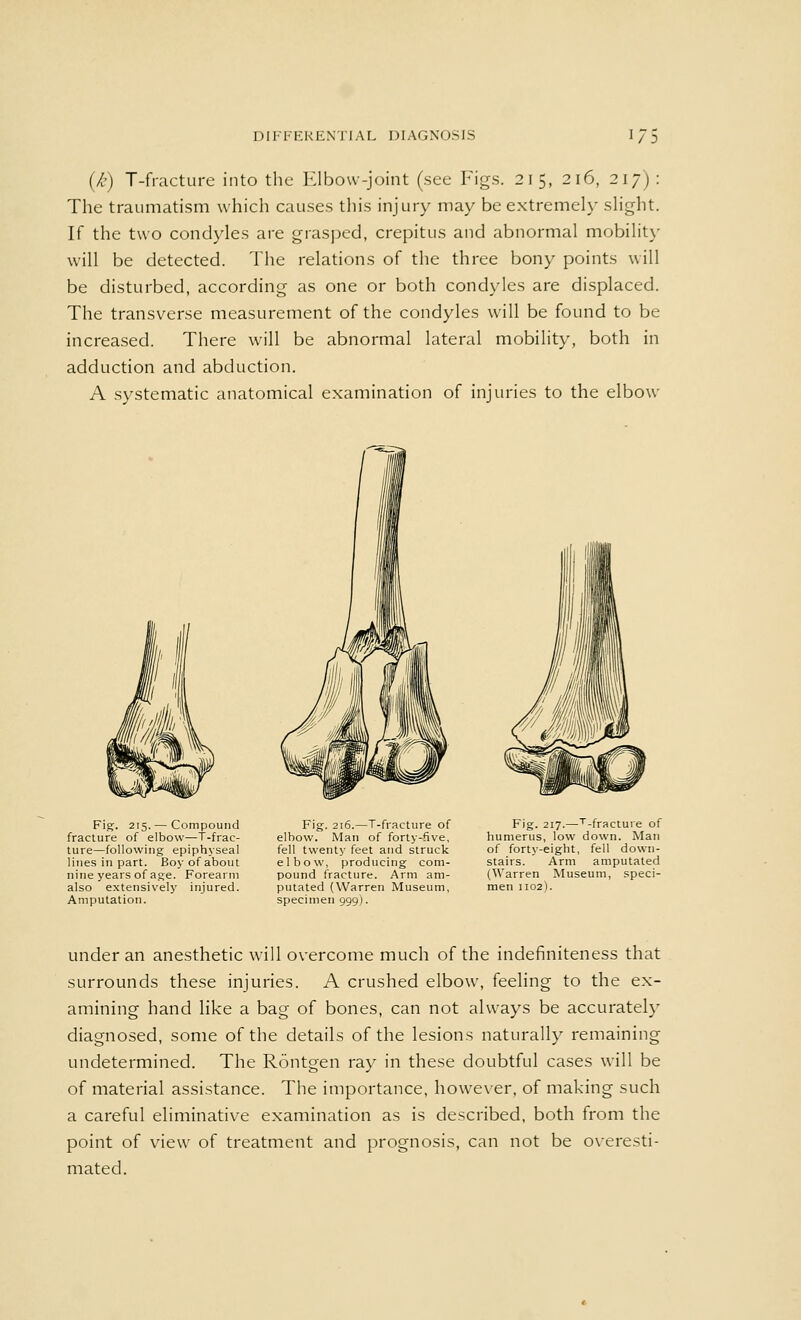 (k) T-fracture into the Elbow-joint (sec Figs. 215, 216, 217;: The traumatism which causes this injury may be extremely slight. If the two condyles are grasped, crepitus and abnormal mobility will be detected. The relations of the three bony points will be disturbed, according as one or both condyles are displaced. The transverse measurement of the condyles will be found to be increased. There will be abnormal lateral mobility, both in adduction and abduction. A systematic anatomical examination of injuries to the elbow Fig. 215. — Compound fracture of elbow—T-frac- ture—following epiphyseal lines in part. Boy of about nine years of age. Forearm also extensively injured. Amputation. Fig. 216.—T-fracture of elbow. Man of forty-five, fell twenty feet and struck elbow, producing com- pound fracture. Arm am- putated (Warren Museum, specimen 999). Fig. 217.—T-fracture of humerus, low down. Man of forty-eight, fell down- stairs. Arm amputated (Warren Museum, speci- men 1102). under an anesthetic will overcome much of the indenniteness that surrounds these injuries. A crushed elbow, feeling to the ex- amining hand like a bag of bones, can not always be accurately diagnosed, some of the details of the lesions naturally remaining undetermined. The Rontgen ray in these doubtful cases will be of material assistance. The importance, however, of making such a careful eliminative examination as is described, both from the point of view of treatment and prognosis, can not be overesti- mated.