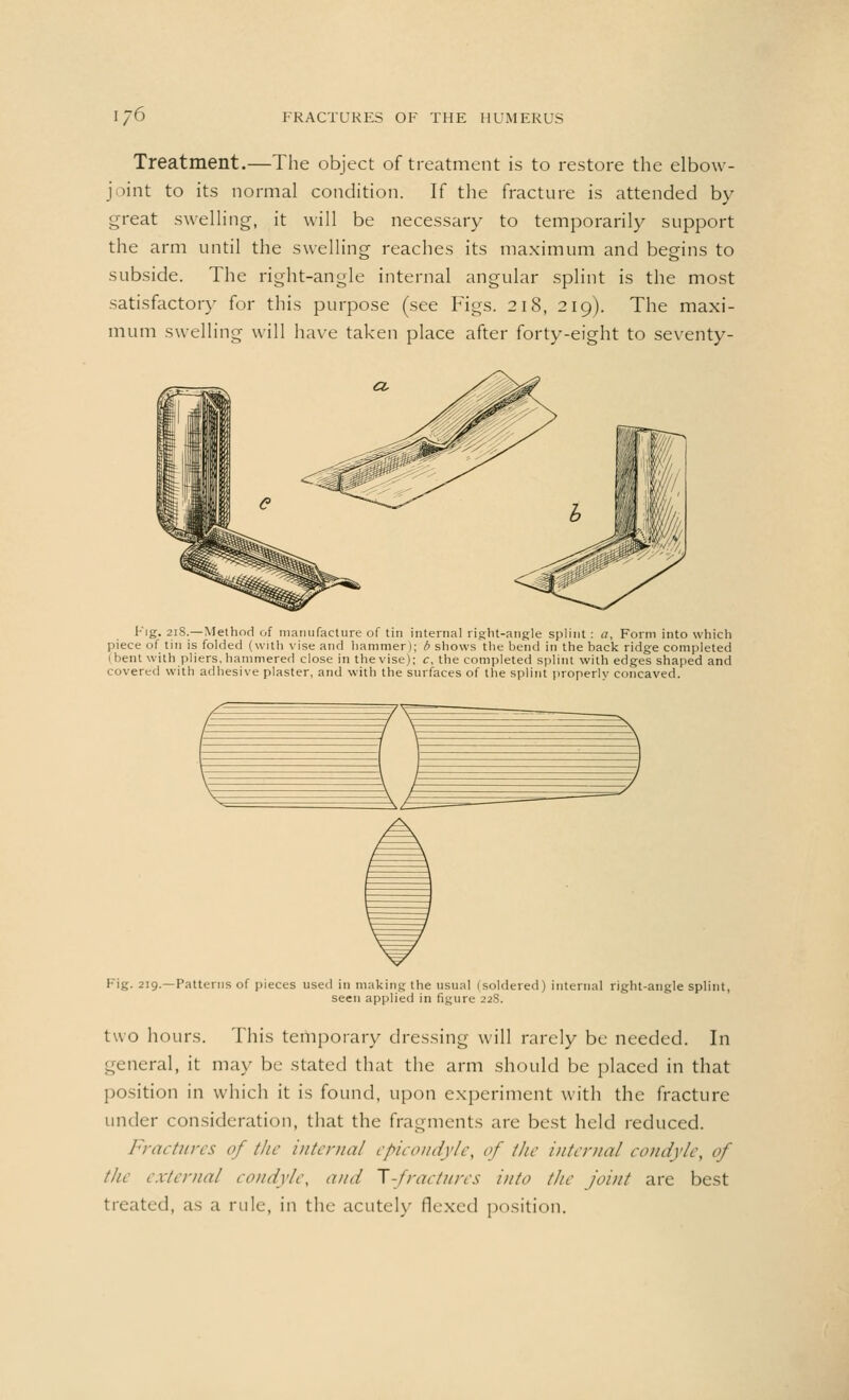 Treatment.—The object of treatment is to restore the elbow- joint to its normal condition. If the fracture is attended by great swelling, it will be necessary to temporarily support the arm until the swelling reaches its maximum and begins to subside. The right-angle internal angular splint is the most satisfactory for this purpose (see Figs. 218, 219). The maxi- mum swelling will have taken place after forty-eight to seventy- Fig. 218.—Method of manufacture of tin internal right-angle splint : a, Form into which piece of tin is folded (with vise and hammer); b shows the bend in the back ridge completed bent with pliers, hammered close in the vise); c, the completed splint with edges shaped and covered with adhesive plaster, and with the surfaces of the splint properlv concaved. Fig. 219.—Patterns of pieces used in making the usual (soldered) internal right-angle splint, seen applied in figure 228. two hours. This temporary dressing will rarely be needed. In general, it may be stated that the arm should be placed in that position in which it is found, upon experiment with the fracture under consideration, that the fragments are best held reduced. Fractures of the internal epicondyle, of the internal condyle, of the external condyle, and T-fraetnres into the joint are best treated, as a rule, in the acutely flexed position.