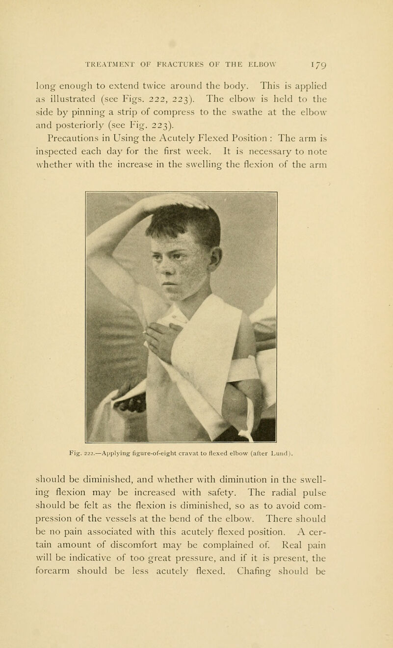 long enough to extend twice around the body. This is applied as illustrated (see Figs. 222, 223). The elbow is held to the side by pinning a strip of compress to the swathe at the elbow and posteriorly (see Fig. 223). Precautions in Using the Acutely Flexed Position : The arm is inspected each day for the first week. It is necessary to note whether with the increase in the swelling the flexion of the arm Fig. 222.—Applying figure-of-eight cravat to flexed elbow (after Lund). should be diminished, and whether with diminution in the swell- ing flexion may be increased with safety. The radial pulse should be felt as the flexion is diminished, so as to avoid com- pression of the vessels at the bend of the elbow. There should be no pain associated with this acutely flexed position. A cer- tain amount of discomfort may be complained of. Real pain will be indicative of too great pressure, and if it is present, the forearm should be less acutely flexed. Chafing should be
