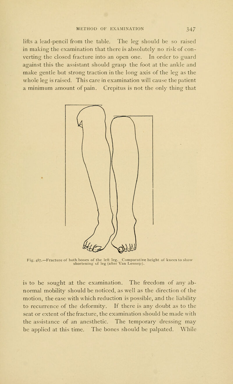lifts a lead-pencil from the table. The leg should be so raised in making the examination that there is absolutely no risk of con- verting the closed fracture into an open one. In order to guard against this the assistant should grasp the foot at the ankle and make gentle but strong traction in the long axis of the leg as the whole leg is raised. This care in examination will cause the patient a minimum amount of pain. Crepitus is not the only thing that Fig. 487.—Fracture of both bones of the left leg. Comparative height of knees to show shortening of leg (after Van Leimep). is to be sought at the examination. The freedom of any ab- normal mobility should be noticed, as well as the direction of the motion, the ease with which reduction is possible, and the liability to recurrence of the deformity. If there is any doubt as to the seat or extent of the fracture, the examination should be made with the assistance of an anesthetic. The temporary dressing may be applied at this time. The bones should be palpated. While