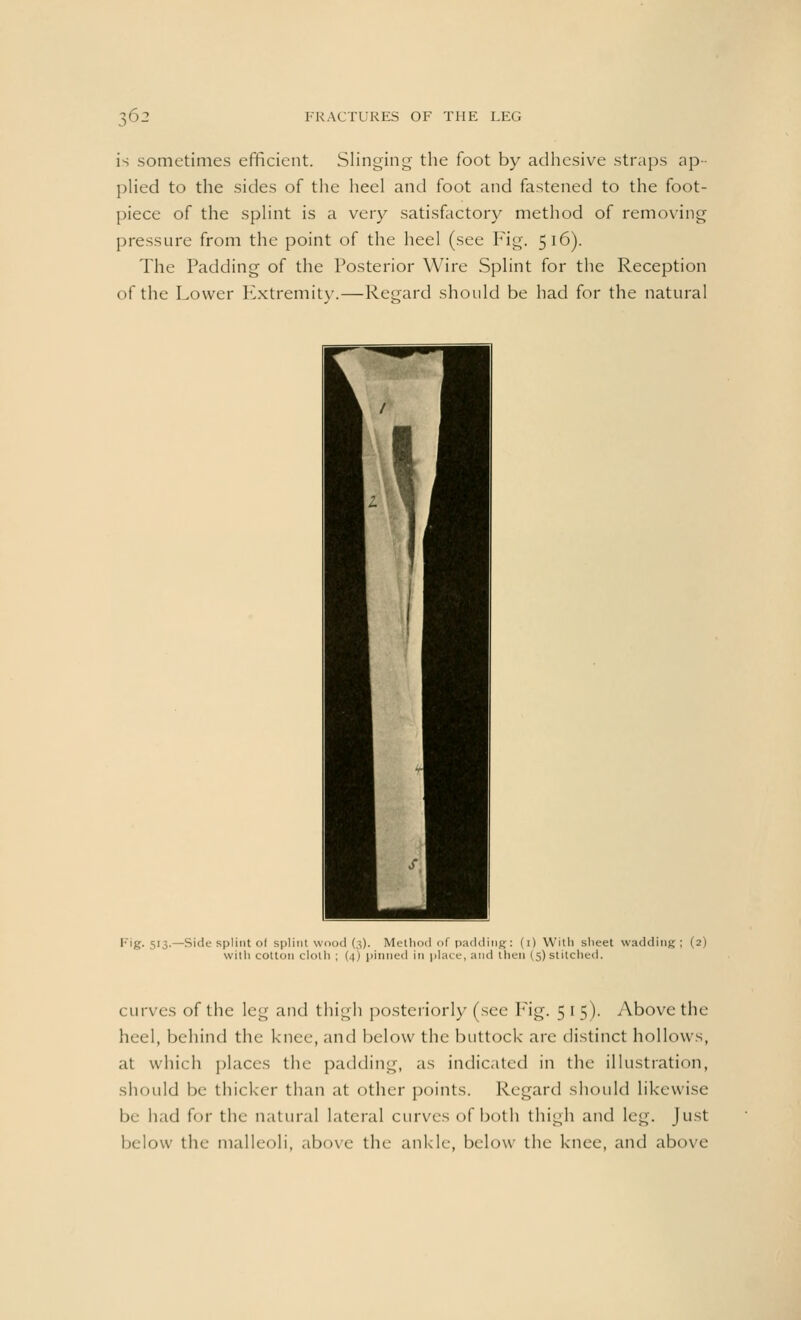 is sometimes efficient. Slinging the foot by adhesive straps ap- plied to the sides of the heel and foot and fastened to the foot- piece of the splint is a very satisfactory method of removing pressure from the point of the heel (see Fig. 516). The Padding of the Posterior Wire Splint for the Reception of the Lower Extremity.—Regard should be had for the natural Fig. 513.—Side splint oi splint wood (3). Method of padding: (1) With sheet wadding; (2) with cotton cloth ; (4) pinned in place, and then (5) stitched. curves of the leg and thigh posteriorly (see Fig. 515). Above the heel, behind the knee, and below the buttock arc distinct hollows, at which places the padding, as indicated in the illustration, should be thicker than at other points. Regard should likewise br had for the natural lateral curves of both thigh and leg. Just below the malleoli, above the ankle, below the knee, and above