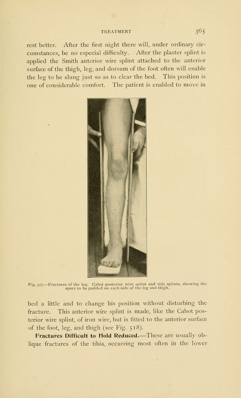 rest better. After the first night there will, under ordinary cir- cumstances, be no especial difficulty. After the plaster splint is applied the Smith anterior wire splint attached to the anterior surface of the thigh, leg, and dorsum of the foot often will enable the leg to be slung just so as to clear the bed. This position is one of considerable comfort. The patient is enabled to move in Fig. 517.—Fractures of the leg. Cabot posterior wire splint and side splints, showing the space to be padded on each side of the leg and thigh. bed a little and to change his position without disturbing the fracture. This anterior wire splint is made, like the Cabot pos- terior wire splint, of iron wire, but is fitted to the anterior surface of the foot, leg, and thigh (see Fig. 518). Fractures Difficult to Hold Reduced.—These are usually ob- lique fractures of the tibia, occurring most often in the lower