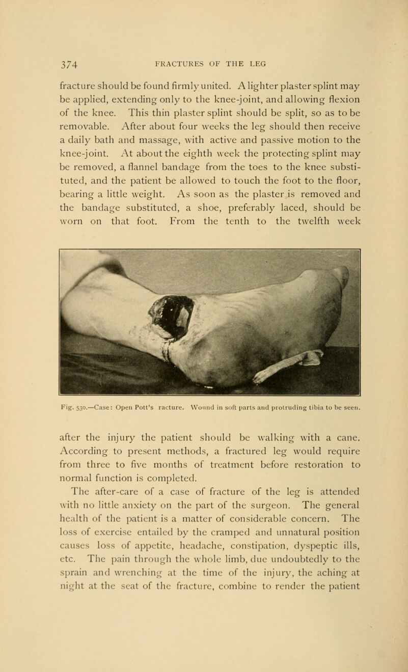 fracture should be found firmly united. A lighter plaster splint may be applied, extending only to the knee-joint, and allowing flexion of the knee. This thin plaster splint should be split, so as to be removable. After about four weeks the leg should then receive a daily bath and massage, with active and passive motion to the knee-joint. At about the eighth week the protecting splint may be removed, a flannel bandage from the toes to the knee substi- tuted, and the patient be allowed to touch the foot to the floor, bearing a little weight. As soon as the plaster is removed and the bandage substituted, a shoe, preferably laced, should be worn on that foot. From the tenth to the twelfth week Fig. 530.—Case: Open Pott's racture. Wound in soft parts and protruding tibia to be seen. after the injury the patient should be walking with a cane. According to present methods, a fractured leg would require from three to five months of treatment before restoration to normal function is completed. The after-care of a case of fracture of the leg is attended with no little anxiety on the part of the surgeon. The general health of the patient is a matter of considerable concern. The loss of exercise entailed by the cramped and unnatural position 1 .iiisrs loss of appetite, headache, constipation, dyspeptic ills, etc. The pain through the whole limb, due undoubtedly to the sprain and wrenching at the time of the injur}-, the aching at night at tin- seal of the fracture, combine to render the patient