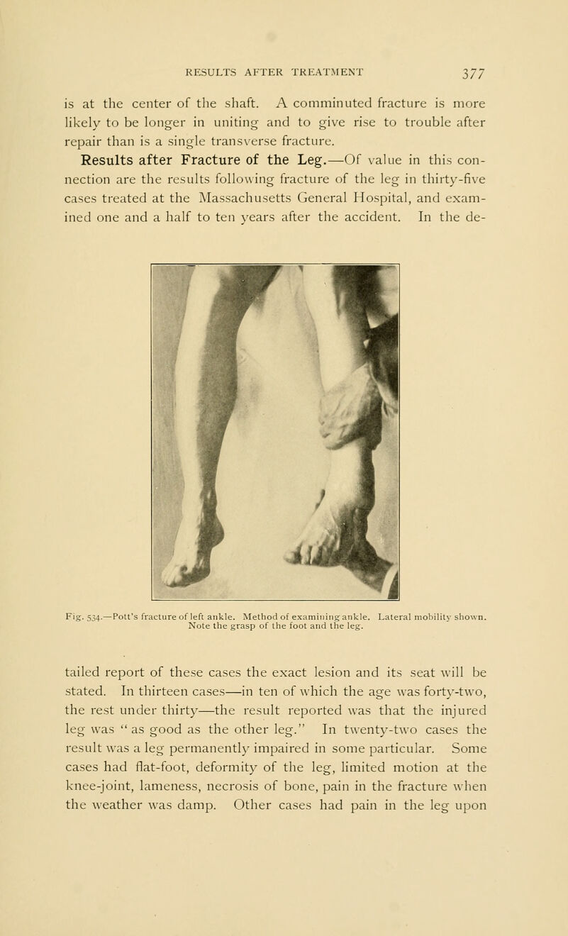 is at the center of the shaft. A comminuted fracture is more likely to be longer in uniting and to give rise to trouble after repair than is a single transverse fracture. Results after Fracture of the Leg.—Of value in this con- nection are the results following fracture of the leg in thirty-five cases treated at the Massachusetts General Hospital, and exam- ined one and a half to ten years after the accident. In the de- Fig. 534.—Pott's fracture of left ankle. Method of examining ankle. Lateral mobility shown. Note the grasp of the foot and the leg. tailed report of these cases the exact lesion and its seat will be stated. In thirteen cases—in ten of which the age was forty-two, the rest under thirty—the result reported was that the injured leg was as good as the other leg. In twenty-two cases the result was a leg permanently impaired in some particular. Some cases had flat-foot, deformity of the leg, limited motion at the knee-joint, lameness, necrosis of bone, pain in the fracture when the weather was damp. Other cases had pain in the leg upon
