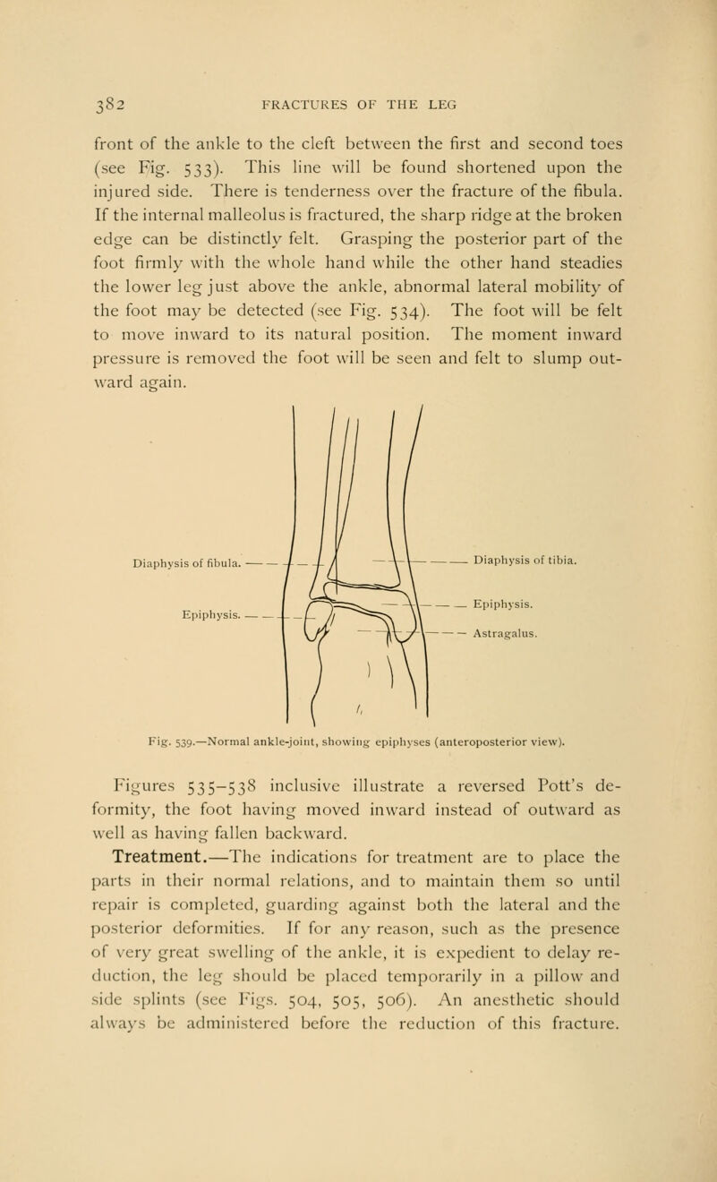 front of the ankle to the cleft between the first and second toes (see Fig. 533). This line will be found shortened upon the injured side. There is tenderness over the fracture of the fibula. If the internal malleolus is fractured, the sharp ridge at the broken edge can be distinctly felt. Grasping the posterior part of the foot firmly with the whole hand while the other hand steadies the lower leg just above the ankle, abnormal lateral mobility of the foot may be detected (see Fig. 534). The foot will be felt to move inward to its natural position. The moment inward pressure is removed the foot will be seen and felt to slump out- ward aeain. Diaphysis of fibula. Epiphysis. Diaphysis of tibia. Epiphysis. Astragalus. Fig. 539.—Normal ankle-joint, showing epiphyses (anteroposterior view). Figures 535—538 inclusive illustrate a reversed Pott's de- formity, the foot having moved inward instead of outward as well as having fallen backward. Treatment.—The indications for treatment are to place the parts in their normal relations, and to maintain them so until repair is completed, guarding against both the lateral and the posterior deformities. If for any reason, such as the presence of very great swelling of the ankle, it is expedient to delay re- duction, the leg should be placed temporarily in a pillow and side splints (see Figs. 504, 505, 506). An anesthetic should always be administered before the reduction of this fracture.