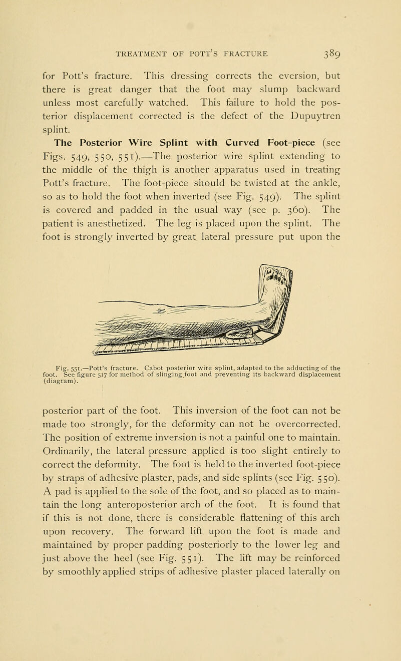 for Pott's fracture. This dressing corrects the eversion, but there is great danger that the foot may slump backward unless most carefully watched. This failure to hold the pos- terior displacement corrected is the defect of the Dupuytren splint. The Posterior Wire Splint with Curved Foot=piece (see Figs. 549, 550, 551).—The posterior wire splint extending to the middle of the thigh is another apparatus used in treating Pott's fracture. The foot-piece should be twisted at the ankle, so as to hold the foot when inverted (see Fig. 549). The splint is covered and padded in the usual way (see p. 360). The patient is anesthetized. The leg is placed upon the splint. The foot is strongly inverted by great lateral pressure put upon the Fig. 551.—Pott's fracture. Cabot posterior wire splint, adapted to the adducting of the foot. See figure 517 for method of slingingfoot and preventing its backward displacement (diagram). posterior part of the foot. This inversion of the foot can not be made too strongly, for the deformity can not be overcorrected. The position of extreme inversion is not a painful one to maintain. Ordinarily, the lateral pressure applied is too slight entirely to correct the deformity. The foot is held to the inverted foot-piece by straps of adhesive plaster, pads, and side splints (see Fig. 550). A pad is applied to the sole of the foot, and so placed as to main- tain the long anteroposterior arch of the foot. It is found that if this is not done, there is considerable flattening of this arch upon recovery. The forward lift upon the foot is made and maintained by proper padding posteriorly to the lower leg and just above the heel (see Fig. 551). The lift may be reinforced by smoothly applied strips of adhesive plaster placed laterally on