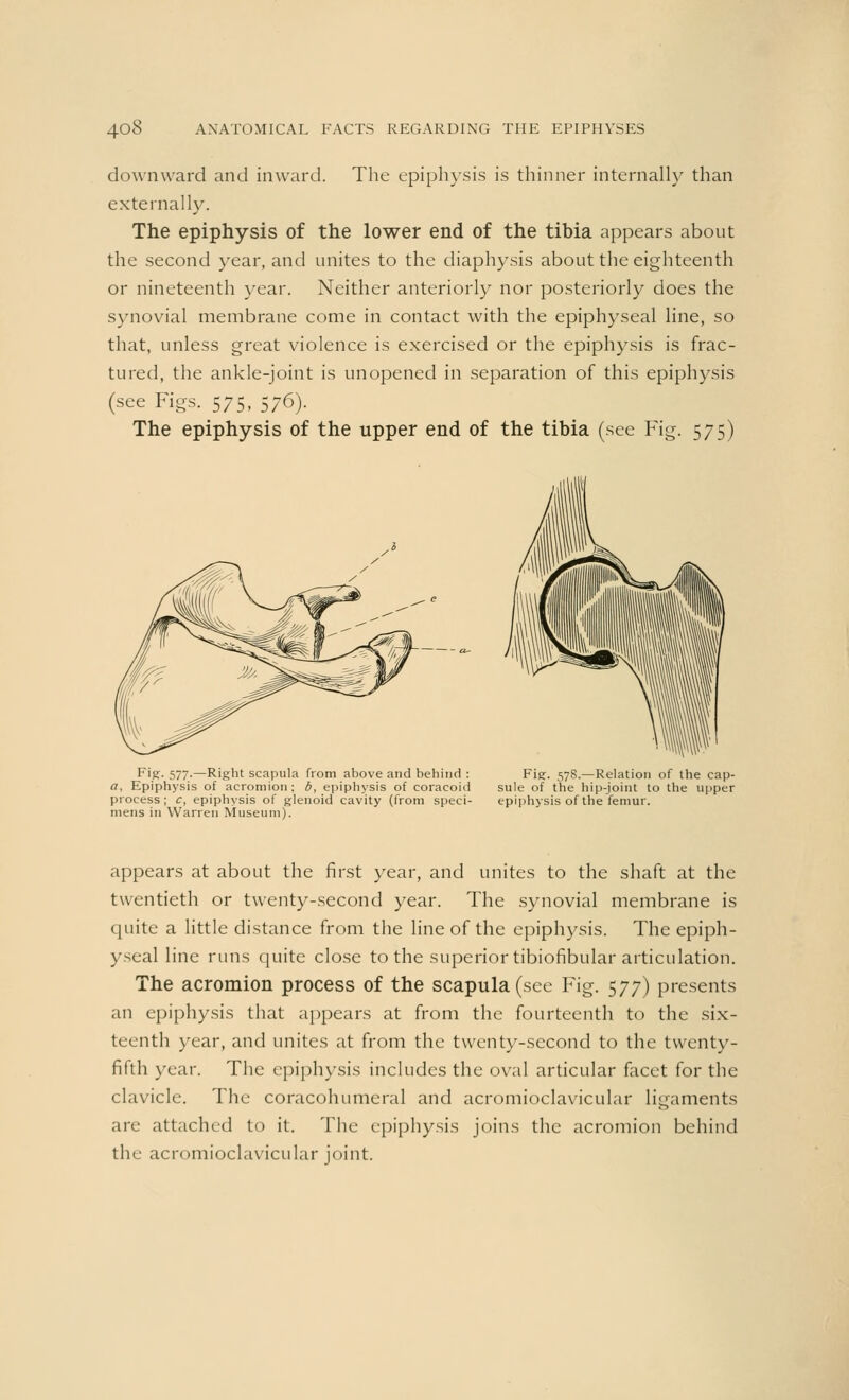 downward and inward. The epiphysis is thinner internally than externally. The epiphysis of the lower end of the tibia appears about the second year, and unites to the diaphysis about the eighteenth or nineteenth year. Neither anteriorly nor posteriorly does the synovial membrane come in contact with the epiphyseal line, so that, unless great violence is exercised or the epiphysis is frac- tured, the ankle-joint is unopened in separation of this epiphysis (see Figs. 575, 576). The epiphysis of the upper end of the tibia (see Fig. 575) Fi.K- 577-—Right scapula from above and behind : Fig. 578.—Relation of the cap- a, Epiphysis of acromion; b, epiphysis of coracoid sule of the hip-joint to the upper process; c, epiphysis of glenoid cavity (from speci- epiphysis of the femur, mens in Warren Museum). appears at about the first year, and unites to the shaft at the twentieth or twenty-second year. The synovial membrane is quite a little distance from the line of the epiphysis. The epiph- yseal line runs quite close to the superior tibiofibular articulation. The acromion process of the scapula (see Fig. 577) presents an epiphysis that appears at from the fourteenth to the six- teenth year, and unites at from the twenty-second to the twenty- fifth year. The epiphysis includes the oval articular facet for the clavicle. The coracohumeral and acromioclavicular ligaments are attached to it. The epiphysis joins the acromion behind the acromioclavicular joint.