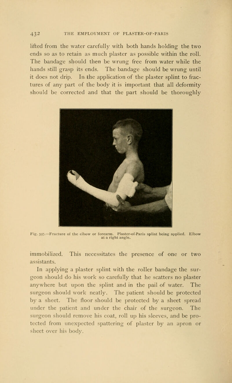 lifted from the water carefully with both hands holding the two ends so as to retain as much plaster as possible within the roll. The bandage should then be wrung free from water while the hands still grasp its ends. The bandage should be wrung until it does not drip. In the application of the plaster splint to frac- tures of any part of the body it is important that all deformity should be corrected and that the part should be thoroughly Fig. 59.—Fracture of the elbow or forearm. Plaster-of-Paris splint being applied. Elbow at a right angle. immobilized. This necessitates the presence of one or two assistants. In applying a plaster splint with the roller bandage the sur- geon should do his work so carefully that he scatters no plaster anywhere but upon the splint and in the pail of water. The surgeon should work neatly. The patient should be protected by a sheet. The floor should be protected by a sheet spread under the patient and under the chair of the surgeon. The surgeon should remove his coat, roll up his sleeves, and be pro- tected from unexpected spattering of plaster by an apron or sheet over his body.