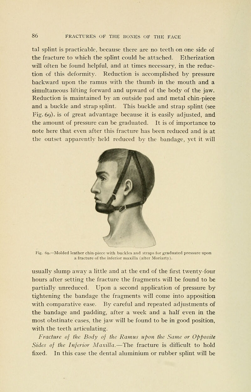 tal splint is practicable, because there are no teeth on one side of the fracture to which the splint could be attached. Etherization will often be found helpful, and at times necessary, in the reduc- tion of this deformity. Reduction is accomplished by pressure backward upon the ramus with the thumb in the mouth and a simultaneous lifting forward and upward of the body of the jaw. Reduction is maintained by an outside pad and metal chin-piece and a buckle and strap splint. This buckle and strap splint (see Fig. 69). is of great advantage because it is easily adjusted, and the amount of pressure can be graduated. It is of importance to note here that even after this fracture has been reduced and is at the outset apparently held reduced by the bandage, yet it will Fig. 69.—Molded leather chin-piece with buckles and straps for graduated pressure upon a fracture of the inferior maxilla (after Moriarty). usually slump away a little and at the end of the first twenty-four hours after setting the fracture the fragments will be found to be partially unreduced. Upon a second application of pressure by tightening the bandage the fragments will come into apposition with comparative ease. By careful and repeated adjustments of the bandage and padding, after a week and a half even in the most obstinate cases, the jaw will be found to be in good position, with the teeth articulating. Fracture of the Body of the Ramus upon the Same or Opposite Sides of the Inferior Maxilla.—The fracture is difficult to hold fixed. In this case the dental aluminium or rubber splint will be