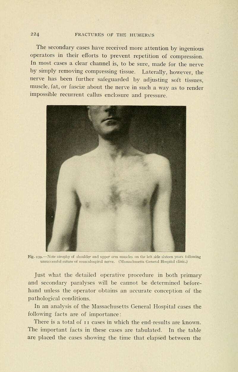 The secondary cases have received more attention by ingenious operators in their efforts to prevent repetition of compression. In most cases a clear channel is, to be sure, made for the nerve by simply removing compressing tissue. Laterally, however, the nerve has been further safeguarded by adjusting soft tissues, muscle, fat, or fasciae about the nerve in such a way as to render impossible recurrent callus enclosure and pressure. Fig. 23p.—Xote atrophy of shoulder and upper arm iiiumIl-t on the left side sixteen years following unsuccessful suture of musculospiral nerve. (Massachusetts General Hospital clinic.) Just what the detailed operative procedure in both primary and secondary paralyses will be cannot be determined before- hand unless the operator obtains an accurate conception of the pathological conditions. In an analysis of the Massachusetts General Hospital cases the following facts are of importance: There is a total of 11 cases in which the end-results are known. The important facts in these cases are tabulated. In the table are placed the cases showing the time that elapsed between the