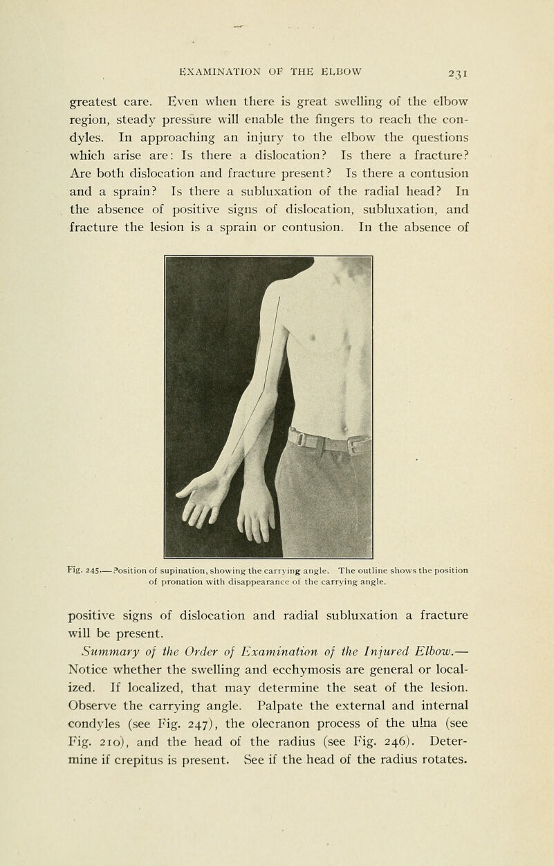 greatest care. Even when there is great swelHng of the elbow region, steady pressure will enable the fingers to reach the con- dyles. In approaching an injury to the elbow the questions which arise are: Is there a dislocation? Is there a fracture? Are both dislocation and fracture present? Is there a contusion and a sprain? Is there a subluxation of the radial head? In the absence of positive signs of dislocation, subluxation, and fracture the lesion is a sprain or contusion. In the absence of Fig. 245.. -Position of supination, showing the carrying angle. The outline shows the position of pronation with disappearance of the carrying angle. positive signs of dislocation and radial subluxation a fracture will be present. Summary of the Order of Examination of the Injured Elbow.— Notice whether the swelling and ecchymosis are general or local- ized. If localized, that may determine the seat of the lesion. Observe the carrying angle. Palpate the external and internal condyles (see Fig. 247), the olecranon process of the ulna (see Fig. 210), and the head of the radius (see Fig. 246). Deter- mine if crepitus is present. See if the head of the radius rotates.