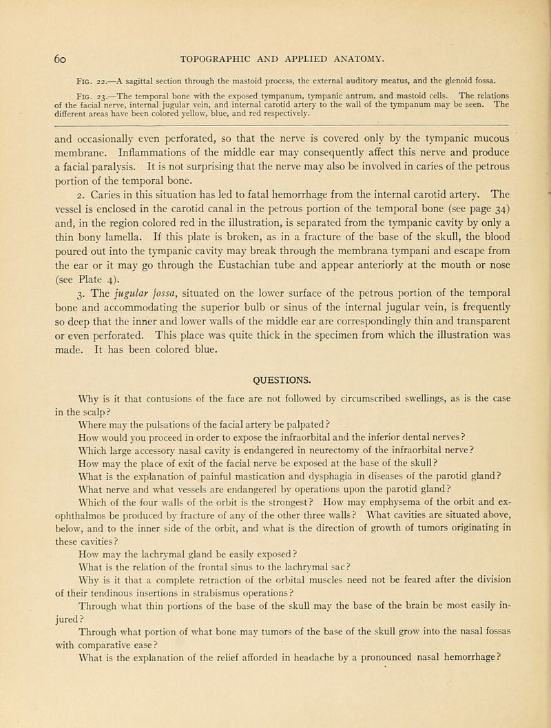 Fig. 22.—A sagittal section through the mastoid process, the external auditory meatus, and the glenoid fossa. Fig. 23.—The temporal bone with the exposed tympanum, tympanic antrum, and mastoid cells. The relations of the facial nerve, internal jugular vein, and internal carotid artery to the wall of the tympanum may be seen. The different areas have been colored yellow, blue, and red respectively. and occasionally even perforated, so that the nerve is covered only by the tympanic mucous membrane. Inflammations of the middle ear may consequently affect this nerve and produce a facial paralysis. It is not surprising that the nerve may also be involved in caries of the petrous portion of the temporal bone. 2. Caries in this situation has led to fatal hemorrhage from the internal carotid artery. The vessel is enclosed in the carotid canal in the petrous portion of the temporal bone (see page 34) and, in the region colored red in the illustration, is separated from the tjonpanic cavity by only a thin bony lamella. If this plate is broken, as in a fracture of the base of the skull, the blood poured out into the tympanic cavity may break through the membrana tympani and escape from the ear or it may go through the Eustachian tube and appear anteriorly at the mouth or nose (see Plate 4). 3. The jugular fossa, situated on the lower surface of the petrous portion of the temporal bone and accommodating the superior bulb or sinus of the internal jugular vein, is frequently so deep that the inner and lower walls of the middle ear are correspondingly thin and transparent or even perforated. This place was quite thick in the specimen from which the illustration was made. It has been colored blue. QUESTIONS. Why is it that contusions of the face are not followed by circumscribed swellings, as is the case in the scalp ? Where may the pulsations of the facial artery be palpated ? How would you proceed in order to e.xpose the infraorbital and the inferior dental nerves ? Which large accessory nasal cavity is endangered in neurectomy of the infraorbital nerve? How may the place of exit of the facial nerve be exposed at the base of the skull? ^Vhat is the explanation of painful mastication and dysphagia in diseases of the parotid gland ? What nerve and what vessels are endangered by operations upon the parotid gland ? A\Tiich of the four walls of the orbit is the strongest ? How may emphysema of the orbit and ex- ophthalmos be produced by fracture of any of the other three walls? A\Tiat ca\'ities are situated above, below, and to the inner side of the orbit, and what is the direction of growth of tumors originating in these ca-\dties? How may the lachrymal gland be easily exposed? AVhat is the relation of the frontal sinus to the lachrymal sac? Why is it that a complete retraction of the orbital muscles need not be feared after the division of their tendinous insertions in strabismus operations ? Through what thin portions of the base of the skull may the base of the brain be most easily in- jured ? Through what portion of what bone may tumors of the base of the skull grow into the nasal fossas with comparative ease ? What is the explanation of the rehef afforded in headache by a pronounced nasal hemorrhage?