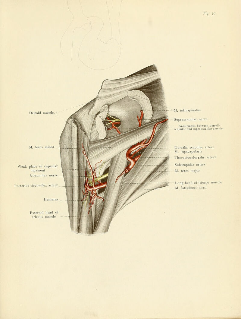 Deltoid muscle Weak place in capsuhr ligament Circumflex nene Posterior circumflex arter) External head of triceps muscle M. infraspinatus Suprascapular nerve Anastomosis between dorsalis scapulae and suprascapular arteries. Dorsalis scapulae artery M. supscapularis Thoracico-dorsalis artery Subscapular artery M. teres major Long head of triceps muscle M. latissimus dorsi