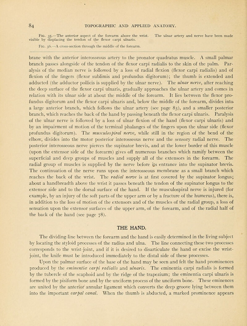 Fig. 35.—The anterior aspect of the forearm above the wrist. The ulnar artery and nerve have been made visible by displacing the tendon of the flexor carpi ulnaris. Fig. 36.—A cross-section through the middle of the forearm. brane with the anterior interosseous artery to the pronator quadratus muscle. A small palmar branch passes alongside of the tendon of the flexor carpi radialis to the skin of the palm. Par- alysis of the median nerve is followed by a loss of radial flexion (flexor carpi radiahs) and of flexion of the fingers (flexor sublimis and profundus digitorum); the thumb is extended and adducted (the adductor pollicis is supplied by the ulnar nerve). The ulnar nerve, after reaching the deep surface of the flexor carpi ulnaris, gradually approaches the ulnar artery and comes in relation with its ulnar side at about the middle of the forearm. It lies between the flexor pro- fundus digitorum and the flexor carpi ulnaris and, below the middle of the forearm, divides into a large anterior branch, which follows the ulnar artery (see page 83), and a smaller posterior branch, which reaches the back of the hand by passing beneath the flexor carpi ulnaris. Paralysis of the ulnar nerve is followed by a loss of ulnar flexion of the hand (flexor carpi ulnaris) and by an impairment of motion of the terminal phalanges of the fingers upon the ulnar side (flexor profundus digitorum). The musculospiral nerve, while still in the region of the bend of the elbow, divides into the motor posterior interosseous nerve and the sensory radial nerve. The posterior interosseous nerve pierces the supinator brevis, and at the lower border of this muscle (upon the extensor side of the forearm) gives off numerous branches which ramify between the superficial and deep groups of muscles and supply all of the extensors in the forearm. The radial group of muscles is supplied by the nerve before iis entrance into the supinator brevis. The continuation of the nerve runs upon the interosseous membrane as a small branch which reaches the back of the wrist. The radial nerve is at first covered by the supinator longus; about a handbreadth above the wrist it passes beneath the tendon of the supinator longus to the extensor side and to the dorsal surface of the hand. If the musculospiral nerve is injured (for example, by an injury of the soft parts of the upper arm or by a fracture of the humerus), there is, in addition to the loss of motion of the extensors and of the muscles of the radial group, a loss of sensation upon the extensor surfaces of the upper arm, of the forearm, and of the radial half of the back of the hand (see page 78). THE HAND. The dividing-line between the forearm and the hand is easily determined in the living subject by locating the styloid processes of the radius and ulna. The line connecting these two processes corresponds to the wrist-joint, and if it is desired to disarticulate the hand or excise the wrist- joint, the knife must be introduced immediately to the distal side of these processes. Upon the palmar surface of the base of the hand may be seen and felt the hand prominences produced by the eniinenticB carpi radialis and ulnaris. The eminentia carpi radiahs is formed by the tubercle of the scaphoid and by the ridge of the trapezium; the eminentia carpi ulnaris is formed by the pisiform bone and by the unciform process of the unciform bone. These eminences are united by the anterior annular ligament which converts the deep groove lying between them into the important carpal canal. When the thumb is abducted, a marked prominence appears