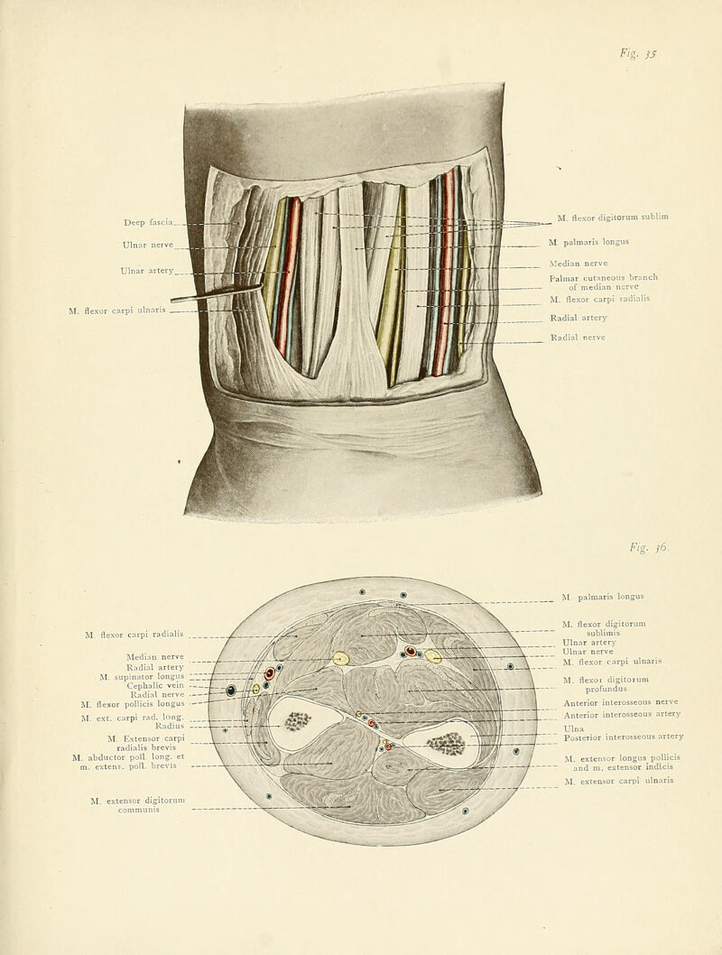 /^'g- iS ^^. flexor carpi ulnn Fig. i6. M, fle rpi radial Median nerve Radial artery M. supinator longus Cephalic vein Radial nerve M, flexor pollicis longus M. ext. carpi rad. long. Radius IM. Extensor carp) radialis brevi M. abductor poll long, m. extens. poll, brevi M. extensor digitoru M palmaris longus i\I. flexor digitorum subliinis Ulnar artery Ulnar nerve IM. flexor carpi ulnaris \^ \ M. flexo. digito.um profundus Anterior interosseous nerve Anterior interosseous artery Ulna Posi M. extensor carpi uln