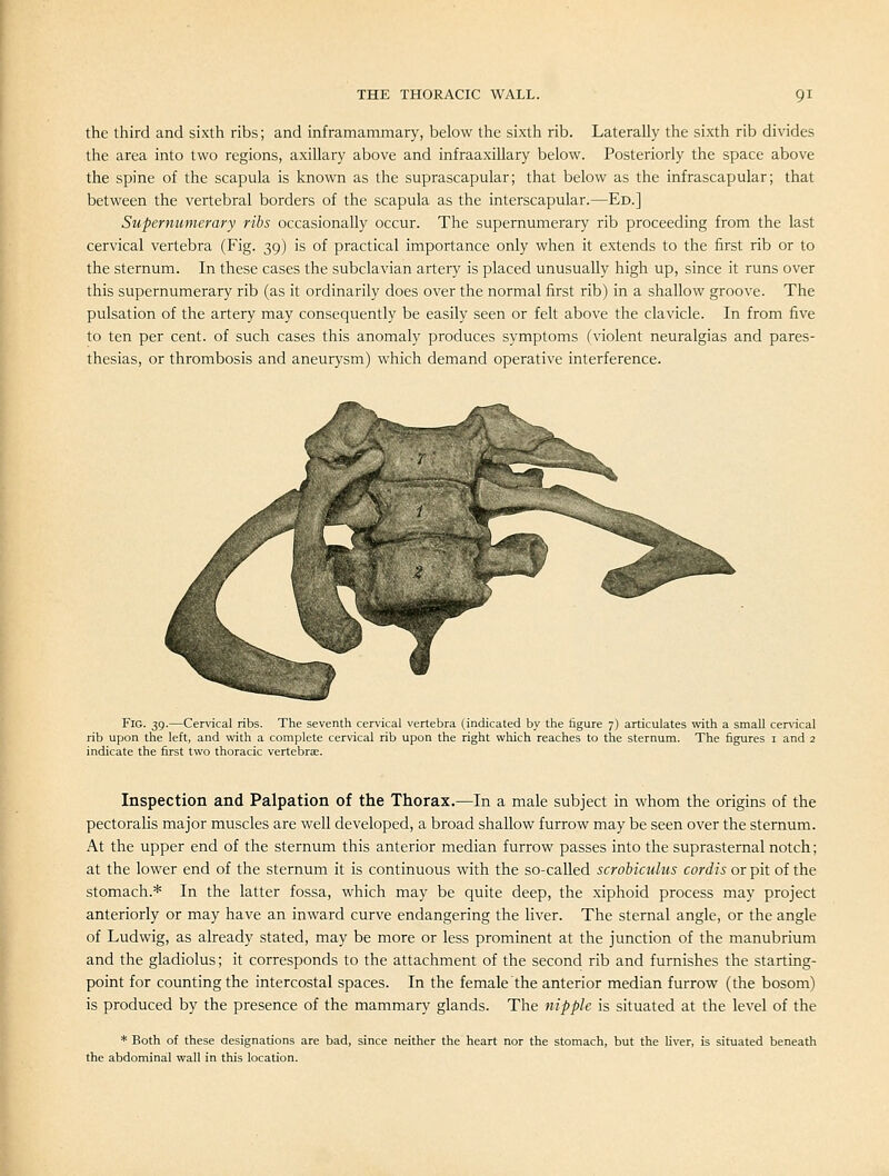 the third and sixth ribs; and inframammary, below the sixth rib. Laterally the sixth rib divides the area into two regions, axillary above and infraaxillary below. Posteriorly the space above the spine of the scapula is known as the suprascapular; that below as the infrascapular; that between the vertebral borders of the scapula as the interscapular.—Ed.] Supernumerary ribs occasionally occur. The supernumerary rib proceeding from the last cervical vertebra (Fig. 39) is of practical importance only when it extends to the first rib or to the sternum. In these cases the subclavian artery is placed unusually high up, since it runs over this supernumerary rib (as it ordinarily does over the normal first rib) in a shallow groove. The pulsation of the artery may consequently be easily seen or felt above the clavicle. In from five to ten per cent, of such cases this anomaly produces symptoms (violent neuralgias and pares- thesias, or thrombosis and aneurysm) which demand operative interference. Fig. 39.—Cervical ribs. The seventh cervical vertebra (indicated by the figure 7) articulates with a small cervical rib upon the left, and with a complete cervical rib upon the right which reaches to the sternum. The figures i and 2 indicate the first two thoracic vertebrae. Inspection and Palpation of the Thorax.—In a male subject in whom the origins of the pectoralis major muscles are well developed, a broad shallow furrow may be seen over the sternum. At the upper end of the sternum this anterior median furrow passes into the suprasternal notch; at the lower end of the sternum it is continuous with the so-called scrobiculus cordis or pit of the stomach.* In the latter fossa, which may be quite deep, the xiphoid process may project anteriorly or may have an inward curve endangering the liver. The sternal angle, or the angle of Ludwig, as already stated, may be more or less prominent at the junction of the manubrium and the gladiolus; it corresponds to the attachment of the second rib and furnishes the starting- point for counting the intercostal spaces. In the female the anterior median furrow (the bosom) is produced by the presence of the mammary glands. The nipple is situated at the level of the * Both of these designations are bad, since neither the heart nor the stomach, but the liver, is situated beneath the abdominal wall in this location.