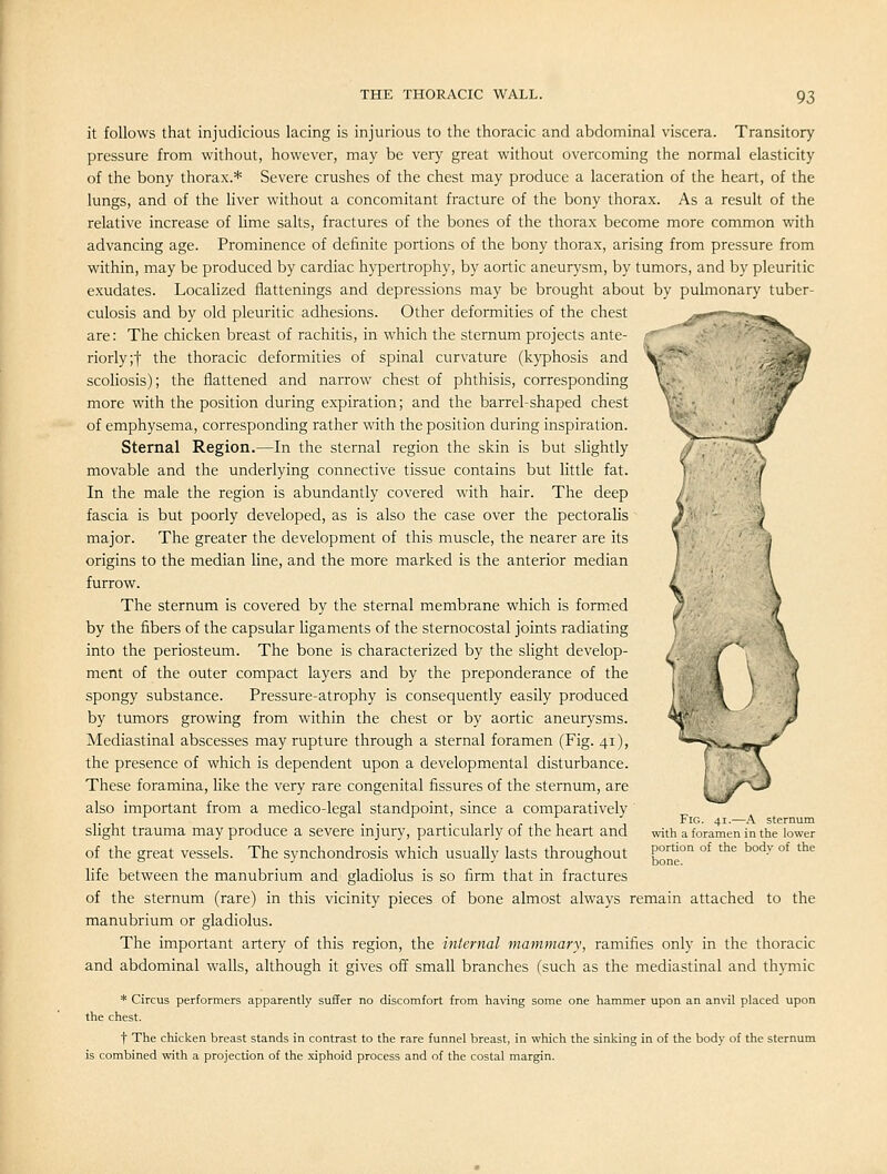 it follows that injudicious lacing is injurious to the thoracic and abdominal viscera. Transitory pressure from without, however, may be very great without overcoming the normal elasticity of the bony thorax.* Severe crushes of the chest may produce a laceration of the heart, of the lungs, and of the liver without a concomitant fracture of the bony thorax. As a result of the relative increase of lime salts, fractures of the bones of the thorax become more common with advancing age. Prominence of definite portions of the bony thorax, arising from pressure from within, may be produced by cardiac hyperti'ophy, by aortic aneurysm, by tumors, and by pleuritic exudates. Localized flattenings and depressions may be brought about by pulmonary tuber- culosis and by old pleuritic adhesions. Other deformities of the chest are: The chicken breast of rachitis, in which the sternum projects ante- riorly ;t the thoracic deformities of spinal curvature (kyphosis and scoliosis); the flattened and narrow chest of phthisis, corresponding more with the position during expiration; and the barrel-shaped chest of emphysema, corresponding rather with the position during inspiration. Sternal Region.—In the sternal region the skin is but shghtly movable and the underlying connective tissue contains but little fat. In the male the region is abundantly covered with hair. The deep fascia is but poorly developed, as is also the case over the pectorahs major. The greater the development of this muscle, the nearer are its origins to the median line, and the more marked is the anterior median furrow. The sternum is covered by the sternal membrane which is formed by the fibers of the capsular Hgaments of the sternocostal joints radiating into the periosteum. The bone is characterized by the slight develop- ment of the outer compact layers and by the preponderance of the spongy substance. Pressure-atrophy is consequently easily produced by tumors growing from within the chest or by aortic aneurysms. Mediastinal abscesses may rupture through a sternal foramen (Fig. 41), the presence of which is dependent upon a developmental disturbance. These foramina, like the very rare congenital fissures of the sternum, are also important from a medico-legal standpoint, since a comparatively slight trauma may produce a severe injury, particularly of the heart and of the great vessels. The synchondrosis which usually lasts throughout life between the manubrium and' gladiolus is so firm that in fractures of the sternum (rare) in this vicinity pieces of bone almost always remain attached to the manubrium or gladiolus. The important artery of this region, the internal mammary, ramifies only in the thoracic and abdominal walls, although it gives off small branches (such as the mediastinal and thymic W^~' Fig. 41.—.\ sternum with a foramen in the lower portion of the body of the bone. * Circus performers apparently suffer no discomfort from having some one hammer upon an an\il placed upon the chest. t The chicken breast stands in contrast to the rare funnel breast, in which the sinking in of the body of the sternum is combined with a projection of the .xiphoid process and of the costal margin.