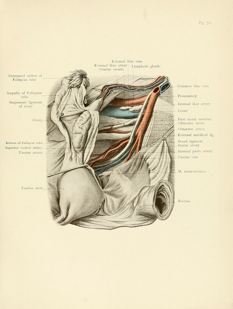 p'g- Ih External iliac vein External iliac artery'; Lymphatic glands I tvarian vessels, ■ Abdominal orifice of Fallopian tube Ampulla of Fallopian lube Suspensory ligament of ovary Ovary Isthmus of Fallopian tube Superior vesical artery Uterine artery Fundus uteri Common iliac vein ^— Promontory Internal iliac artery Ureter First sacral vertebra Obturator nerve Obturator artery K^ternal umbilical lig. I'road ligament Sciatic artery Internal pudic artery Uterine vein M, recto-uterinus