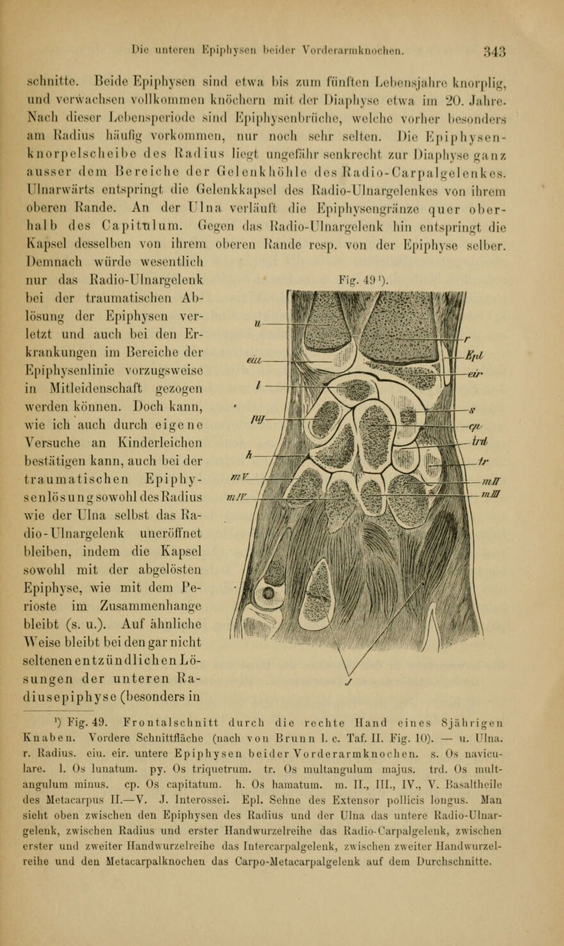 Fig. 49')- schnitte. Beide Epiphysen sind etwa bis zum fünftes Lebensjahre knorplig, und verwachsen vollkommen knöchern mit der Diaphyse etwa im 20. Jahre. Nach dieser Lebensperiode sind Epiphysenbrüche, welche vorher besonders am Radius häufig vorkommen, nur noch sein- selten. Die Epiphysen- knorpelscheibe des Radius liegt ungefähr senkrechl zur Diaphyse ganz ausser dem Bereiche der Gelenkhöhle desRadio-Carpalgelenkes. ülnarwärts entspringt die Gelenkkapsel (\cs Radio-Ulnargelenkes von ihrem oberen Rande. An der Tina, verlauf! die Epiphysengränze quer ober- halb des Capittilum. Gegen das Radio-Ulnargelenk hin entspringl die Kapsel desselben von ihrem oberen Rande resp. von der Epiphyse selber. Demnach würde wesentlich nur das Radio-Ulnargelenk bei der traumatischen Ab- lösung der Epiphysen ver- letzt und auch bei den Er- krankungen im Bereiche der Epiphysenlinie vorzugsweise in Mitleidenschaft gezogen werden können. Doch kann, wie ich auch durch eigene Versuche an Kinderleichen bestätigen kann, auch bei der traumatischen Epiphy- se n lö s u n g sowohl des Rad ius wie der Ulna selbst das Ra- dio-Ulnargelenk uneröffnet bleiben, indem die Kapsel sowohl mit der abgelösten Epiphyse, wie mit dem Pe- rioste im Zusammenhange bleibt (s. u.). Auf ähnliche Weise bleibt bei den gar nicht seltenen entzündlichen Lö- sungen der unteren Ra- diusepiphyse (besonders in ') Fig. 49. Frontalschnitt durch die rechte Hand eines 8jährigen Knaben. Vordere Schnittfläche (nach von Brunn I.e. Taf. II. Fi?. 10). — u. l'lna. r. Radius, ein. eir. untere Epiphysen beider Vorderarmknochen, s. <*s oavicu- lare. I. Os lunatum. py. Os triquetrum. tr. Os multangulum majus. trd. <>s mult- angulum minus, cp. Os capitatum. h. Os hamatum. m. IL, III., IV., V. Basaltheile iles Metacarpus II.— V. J. Interossei. Epl. Seime des Eztensor pollicis Iongus. Man sieht oben zwischen den Epiphysen des Radius und der Ulna das unlere Radio-Ulnar- gelenk, zwischen Radius und erster Handwurzelreihe das Radio-Carpalgelenk, zwischen erster und zweiter Handwurzelreihe das [ntercarpalgelenk, zwischen zweiter Handwurzel- reihe und den Metacarpalknochen das Carpo-JJetacarpalgelenk auf dein Durchschnitte.