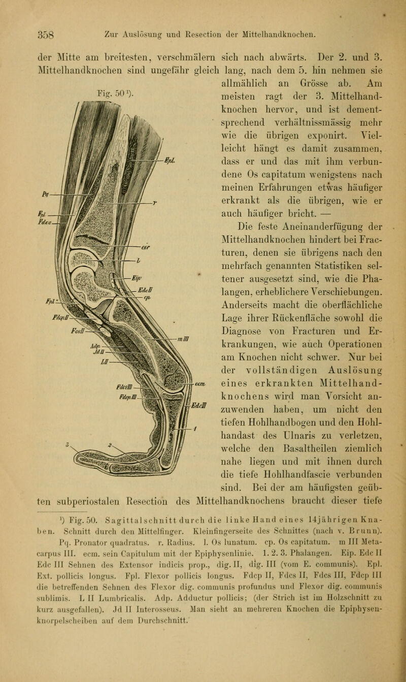 der Mitte am breitesten, verschmälera sich nach abwärts. Der 2. und 3. Mittelhandknochen sind ungefähr gleich lang, nach dem 5. hin nehmen sie allmählich an Grösse ab. Arn meisten ragt der 3. Mittelhand- knochen hervor, und ist dement- sprechend verhältnissmässig mehr wie die übrigen exponirt. Viel- leicht hängt es damit zusammen, dass er und das mit ihm verbun- dene Os capitatum wenigstens nach meinen Erfahrungen etwas häufiger erkrankt als die übrigen, wie er auch häufiger bricht. — Die feste Aneinanderfiigung der Mittelhandknochen hindert bei Frac- turen, denen sie übrigens nach den mehrfach genannten Statistiken sel- tener ausgesetzt sind, wie die Pha- langen, erheblichere Verschiebungen. Anderseits macht die oberflächliche Lage ihrer Rückenfläche sowohl die Diagnose von Fracturen und Er- krankungen, wie auch Operationen am Knochen nicht schwer. Xur bei der vollständigen Auslösung eines erkrankten Mittelhand- knochens wird man Vorsicht an- zuwenden haben, um nicht den tiefen Hohlhandbogen und den Hohl- handast des Ulnaris zu verletzen, welche den Basaltheilen ziemlich nahe liegen und mit ihnen durch die tiefe Ilohlhandfascie verbunden sind. Bei der am häufigsten geüb- ten subperiostalen Resection des Mittelhandknochens braucht dieser tiefe ') Fig. 50. Sagittalschnitt durch die linke Hand eines 14j;'Üirigen Kna- ben. Schnitt durch den Mittelfinger. Kleinfingerseite des Schnittes (nach \. Brunn). Pq. Pronator quadratus. r. Radius. 1. Os lunatum. cp. Os capitatum. mlHMeta- carpus III. ecm. sein Capitulum mit der Epiphysenlinie. 1.2.3. Phalangen. Eip. Eid: II Edc 111 Seimen des Extensor indicis prop., dig.II, dlg. III (vom E. communis). Epl. Ext. pollicis Longus. Epl. Flexor pollicis longus. Edcp II, Fdcs II, Fdcs III, Fdcp III die betreffenden Sehnen des Flexor dig. communis profundus und Flexor dig. communis Bublimis. L II Lumbricalis. Adp. Adductur pollicis; (der Strich Lsl im Holzschnitt zu kurz ausgefallen). .Jd II [nterosseus. .Man sieht, an mehreren Knochen die Epiphysen- knorpelscheiben auf dem Durchschnitt.'