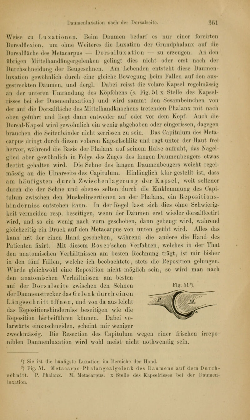 Weise zu Luxationen. Beim Daumen bedarf es nur einer forcirten Dorsalflexion, am ohne Weiteres die Luxati ler Grundphalanx auf die Dorsal fläche des Metacarpus Dorsalluxation zu erzeugen. Anden übrigen Mittelhandfingergelenken geling! dies nicht oder erst nach der Durchschneidung der Beugesehnen. Am Lebenden entsteht diese Daumen- luxation gewöhnlich durch eine gleiche Bewegung beim Fallen auf den aus- gestreckten Daumen, und dergl. Dabei reisst die volare Kapsel regelmässig an der unteren Umrandung des Köpfchens (s. Fig. 51 \ Stelle des Kapsel- risses bei der Daismenluxation) und wird samml den Sesambeinchen von der auf die Dorsalfläche des Mittelhandknochens tretenden Phalanx mit nach oben geführl und Liegt dann entweder auf oder vor dem Kopf. Auch die Dorsal-Kapsel \\ ird gewöhnlich ein wenig abgehoben oder eingerissen, dagegen brauchen die Seitenbänder oichl zerrissen zu sein. Das Capitulum des Meta- carpus dringt durch diesen volaren Kapselschlitz und ragt unter der Haut frei hervor, während die Basis <\rv Phalanx auf seinem Halse aufruht, das Nagel- glied aber gewöhnlich in Folge des Zuges 'U's langen Daumenbeugers etwas flectirt gehalten wird. Die Seime des langen Daumenbeugers weicht regel- mässig an die Ulnarseite des Capitulum. Hinlänglich klargestellt ist, dass am häufigsten durch Zwischenlagern ng der Kapsel, weit seltener durch die der Sehne und ebenso selten durch die Einklemmung *U'> Capi- tulum zwischen den Muskelinsertionen an dvv Phalanx, ein Repositions- hinderniss entstehen k; In der Regel lässt sich dies ohne Schwierig- keit vermeiden resp. beseitigen, wenn der Daumen erst wieder dorsalflectirt wird, und so ein wenig nach vorn geschoben, dann gebeugt wird, während gleichzeitig ein Druck auf den Metacarpus von unten geübt wird. Alles das kann mit der einen Hand geschehen, während die andere die Hand des Patienten lixirt. Mit diesem R us einsehen Verfahren, welches in der That den anatomischen Verhältnissen am besten Rechnung trägt, ist mir bisher in den fünf Fällen, welche ich beobachtete, stets die Reposition gelungen. Würde gleichwohl eine Reposition nicht möglich sein, so wird man nach \\vw anatomischen Verhältnissen am besten auf der Dorsalseite /.wischen den Sehnen Fig. 51 ^ der Daumenstrecker das Gelenk durch einen Längsschnitt öffnen. und von da aus leicht das Repositionshinderniss beseitigen wie die Reposition herbeiführen können. Dabei vo- larwärts einzuschneiden, scheint nur weniger zweckmässig. Die Resection des Capitulum wegen einer irischen irrepo- uiblen Daumenluxation wird wohl meist nicht nothwendic sein. ') Sie ist die häufigste Luxation im Bereiche der Hand. -') Fig. 51. Metacarpo-Phalangealgelenk des Daumens auf dem Durch- Bchnitt. P. Phalanx. M. Metacarpus. i Stelle des Kapselrisses i'i der Daumen- luxation.