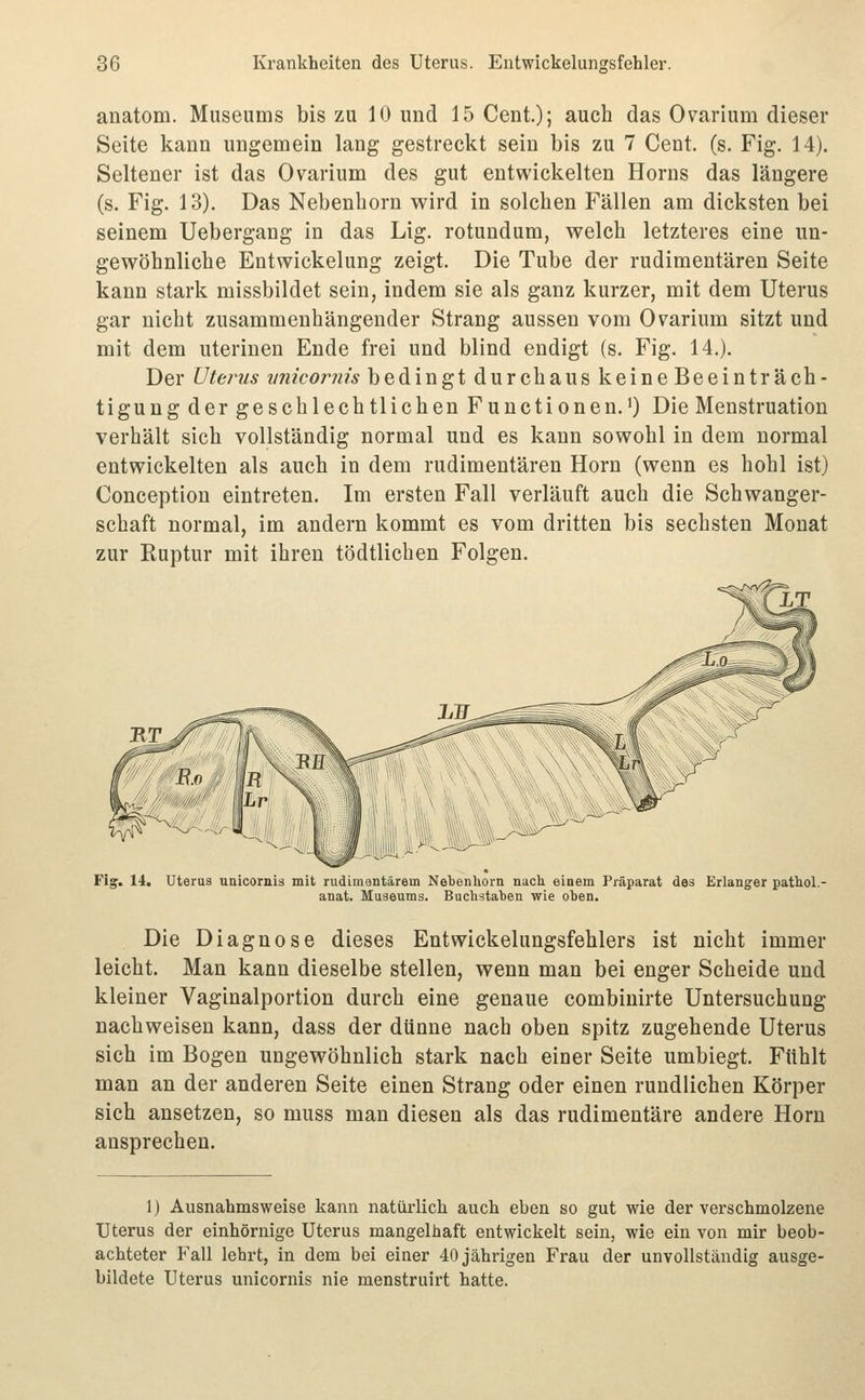 anatom. Museums bis zu 10 und 15 Cent.); auch das Ovarium dieser Seite kann ungemein lang gestreckt sein bis zu 7 Cent. (s. Fig. 14). Seltener ist das Ovarium des gut entwickelten Horns das längere (s. Fig. 13). Das Nebenhorn wird in solchen Fällen am dicksten bei seinem Uebergang in das Lig. rotundum, welch letzteres eine un- gewöhnliche Entwickelung zeigt. Die Tube der rudimentären Seite kann stark missbildet sein, indem sie als ganz kurzer, mit dem Uterus gar nicht zusammenhängender Strang aussen vom Ovarium sitzt und mit dem uterinen Ende frei und blind endigt (s. Fig. 14.). Der Uterus nnicornis bedingt durchaus keine Beeinträch- tigung der geschlechtlichen Functionen.') Die Menstruation verhält sich vollständig normal und es kann sowohl in dem normal entwickelten als auch in dem rudimentären Hörn (wenn es hohl ist) Conception eintreten. Im ersten Fall verläuft auch die Schwanger- schaft normal, im andern kommt es vom dritten bis sechsten Monat zur Ruptur mit ihren tödtlichen Folgen. 14. Uteru3 unicornis mit rudimentärem Nebenhorn nach einem Präparat des Erlanger pattol.- anat. Museums. Buchstaben wie oben. Die Diagnose dieses Entwickelungsfehlers ist nicht immer leicht. Man kann dieselbe stellen, wenn man bei enger Scheide und kleiner Vaginalportion durch eine genaue combinirte Untersuchung nachweisen kann, dass der dünne nach oben spitz zugehende Uterus sich im Bogen ungewöhnlich stark nach einer Seite umbiegt. Fühlt man an der anderen Seite einen Strang oder einen rundlichen Körper sich ansetzen, so muss man diesen als das rudimentäre andere Hörn ansprechen. 1) Ausnahmsweise kann natürlich auch eben so gut wie der verschmolzene Uterus der einhörnige Uterus mangelhaft entwickelt sein, wie ein von mir beob- achteter P'all lehrt, in dem bei einer 40 jährigen Frau der unvollständig ausge- bildete Uterus unicornis nie menstruirt hatte.