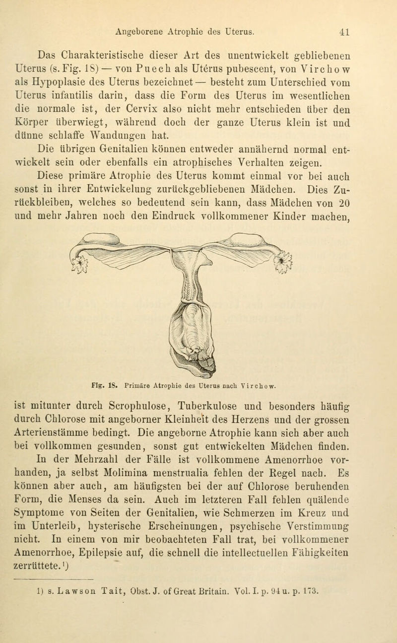 Das Charakteristische dieser Art des unentwickelt gebliebenen Uterus (s.Fig. IS) — von Puech als Uterus pubescent, von Vircho w als Hypoplasie des Uterus bezeichnet— besteht zum Unterschied vom Uterus infautilis darin, dass die Form des Uterus im wesentlichen die normale ist, der Cervix also nicht mehr entschieden über den Körper überwiegt, während doch der ganze Uterus klein ist und dünne schlaffe Wandungen hat. Die übrigen Genitalien können entweder annähernd normal ent- wickelt sein oder ebenfalls ein atrophisches Verhalten zeigen. Diese primäre Atrophie des Uterus kommt einmal vor bei auch sonst in ihrer Entwickelung zurückgebliebenen Mädchen. Dies Zu- rückbleiben, welches so bedeutend sein kann, dass Mädchen von 20 und mehr Jahren noch den Eindruck vollkommener Kinder machen, Fig. 18. Primäre Atrophie des Uterus Dach. Virchow. ist mitunter durch Scrophulose, Tuberkulose und besonders häufig durch Chlorose mit angeborner Kleinheit des Herzens und der grossen Arterienstämme bedingt. Die angeborne Atrophie kann sich aber auch bei vollkommen gesunden, sonst gut entwickelten Mädchen finden. In der Mehrzahl der Fälle ist vollkommene Amenorrhoe vor- handen, ja selbst Molimina menstrualia fehlen der Regel nach. Es können aber auch, am häufigsten bei der auf Chlorose beruhenden Form, die Menses da sein. Auch im letzteren Fall fehlen quälende Symptome von Seiten der Genitalien, wie Schmerzen im Kreuz und im Unterleib, hysterische Erscheinungen, psychische Verstimmung nicht. In einem von mir beobachteten Fall trat, bei vollkommener Amenorrhoe, Epilepsie auf, die schnell die intellectuellen Fähigkeiten zerrüttete.') 1) s.Lawson Tait, Obst. J. of Great Britain. Vol. I. p. 94 u. p. 173.