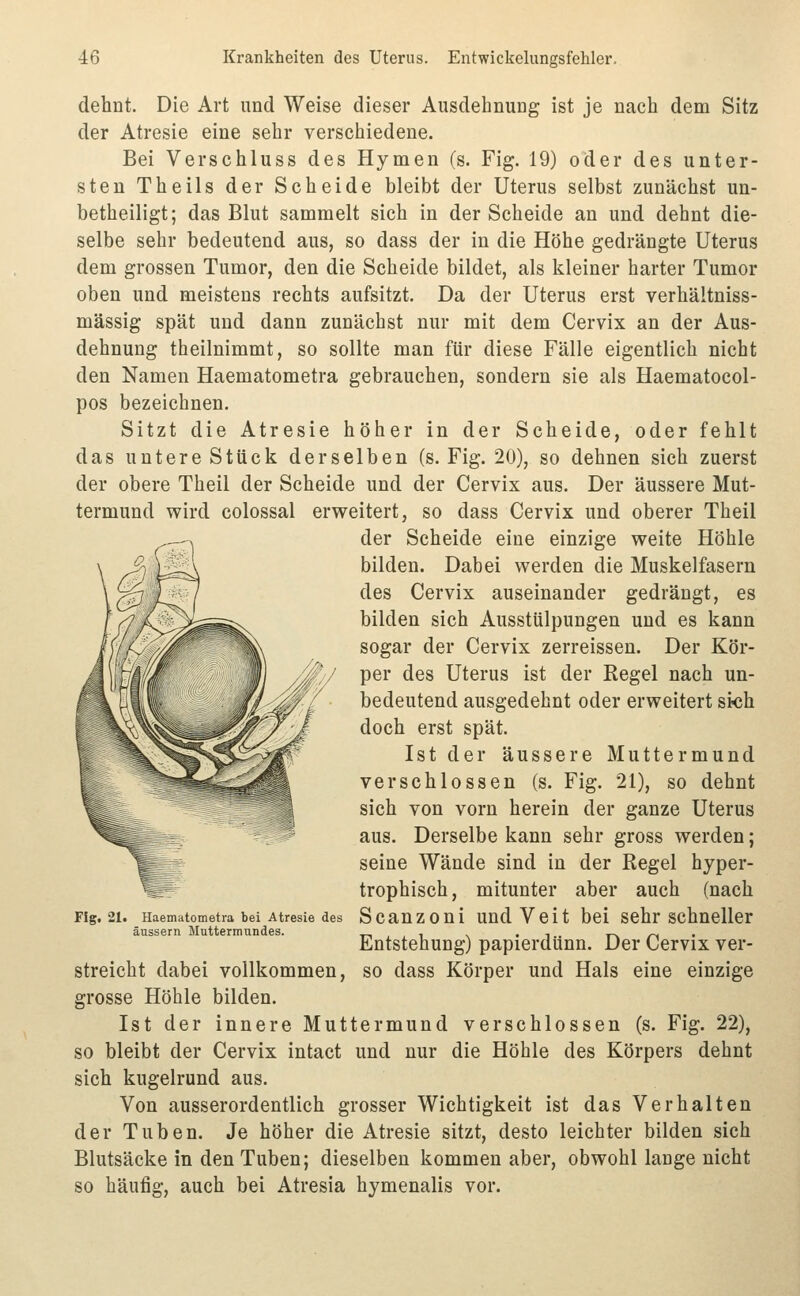 dehnt. Die Art und Weise dieser Ausdehnung ist je nach dem Sitz der Atresie eine sehr verschiedene. Bei Verschluss des Hymen (s. Fig. 19) oder des unter- sten Theils der Scheide bleibt der Uterus selbst zunächst un- betheiligt; das Blut sammelt sich in der Scheide an und dehnt die- selbe sehr bedeutend aus, so dass der in die Höhe gedrängte Uterus dem grossen Tumor, den die Scheide bildet, als kleiner harter Tumor oben und meistens rechts aufsitzt. Da der Uterus erst verhältniss- mässig spät und dann zunächst nur mit dem Cervix an der Aus- dehnung theilnimmt, so sollte man für diese Fälle eigentlich nicht den Namen Haematometra gebrauchen, sondern sie als Haematocol- pos bezeichnen. Sitzt die Atresie höher in der Scheide, oder fehlt das untere Stück derselben (s. Fig. 20), so dehnen sich zuerst der obere Theil der Scheide und der Cervix aus. Der äussere Mut- termund wird colossal erweitert, so dass Cervix und oberer Theil der Scheide eine einzige weite Höhle bilden. Dabei werden die Muskelfasern des Cervix auseinander gedrängt, es bilden sich Ausstülpungen und es kann sogar der Cervix zerreissen. Der Kör- per des Uterus ist der Regel nach un- bedeutend ausgedehnt oder erweitert si«h doch erst spät. Ist der äussere Muttermund verschlossen (s. Fig. 21), so dehnt sich von vorn herein der ganze Uterus aus. Derselbe kann sehr gross werden; seine Wände sind in der Regel hyper- trophisch, mitunter aber auch (nach Scanzoni und Veit bei sehr schneller Entstehung) papierdünn. Der Cervix ver- so dass Körper und Hals eine einzige Flg. 21. Haematometra bei Atresie des äussern Muttermundes. streicht dabei vollkommen, grosse Höhle bilden. Ist der innere Muttermund verschlossen (s. Fig. 22), so bleibt der Cervix intact und nur die Höhle des Körpers dehnt sich kugelrund aus. Von ausserordentlich grosser Wichtigkeit ist das Verhalten der Tuben. Je höher die Atresie sitzt, desto leichter bilden sich Blutsäcke in den Tuben; dieselben kommen aber, obwohl lange nicht so häufig, auch bei Atresia hymenalis vor.