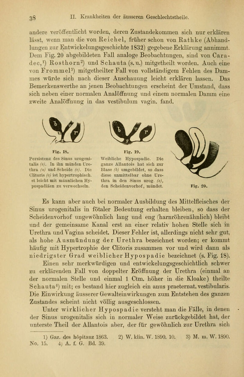 andere veröffentlicht worden, deren Zustandekommen sich nur erklären lässt, wenn man die von Reichel, früher schon von Rathke (Abhand- lungen zur Entwickelungsgeschichte 1832) gegebene Erklärung annimmt. Dem Fig. 20 abgebildeten Fall analoge Beobachtungen, sind von Cara- dec,*) Rosthorn^) und Schauta (s.u.) mitgetheilt worden. Auch eine von FrommeP) mitgetheilter Fall von vollständigem Fehlen des Dam- mes würde sich nach dieser Anschauung leicht erklären lassen. Das Bemerkenswerthe an jenen Beobachtungen erscheint der Umstand, dass sich neben einer normalen Analöffnuug und einem normalen Damm eine zweite Analöflfuuno- in das vestibulnm vaoin. fand. Fig. 18. Persistenz des Sinus urogeni- talis (s). In ihn münden Ure- thra (u) und Scheide (v). Die Clitoris (c) ist hypertrophisch. st leicht mit männlichen Hy- pospadiäen zu verwechseln. V» Fig. 19. Weibliche Hypospadie. Die ganze Allautois hat sich zur Blase (b) umgebildet, so dass diese unmittelbar ohne Ure- thra in den Sinus urog. (s), den Scheidenvorhof, mündet. Fig. 20. Es kann aber auch bei normaler Ausbildung des Mittelüeisches der Sinus urogenitalis in fötaler Bedeutung erhalten bleiben, so dass der Scheidenvorhof ungewöhnlich lang und eng (harnröhrenähnlich) bleibt und der gemeinsame Kanal erst an einer relativ hohen Stelle sich in Urethra und Vagina scheidet. Dieser Fehler ist, allerdings nicht sehr gut, als hohe Ausmündung der Urethra bezeichnet worden; er kommt häufig mit Hypertrophie der Clitoris zusammen vor und wird dann als niedrigster Grad weiblicher Hypospadie bezeichnet (s. Fig. 18). Einen sehr merkwürdigen und entwickelungsgeschichtlich schwer zu erklärenden Fall von doppelter Eröffnung der Urethra (einmal an der normalen Stelle und einmal 1 Ctm. höher in die Kloake) theilte Schauta^) mit; es bestand hier zugleich ein anus praeternat.vestibularis. Die Einwirkung äusserer Gewalteinwirkungen zum Entstehen des ganzen Zustande« scheint nicht völlig ausgeschlossen. Unter wirklicher Hypospadie versteht man die Fälle, in denen der Sinus urogenitalis sich in normaler Weise zurückgebildet hat, der unterste Theil der Allantois aber, der für gewöhnlich zur Urethra sich 1) Gaz. des höpitauz 1863. No. 15. 4j A. f. G. ßd. 39. 2) W. kliij. W. 1890. 10. 3) M. m. W. 1890.