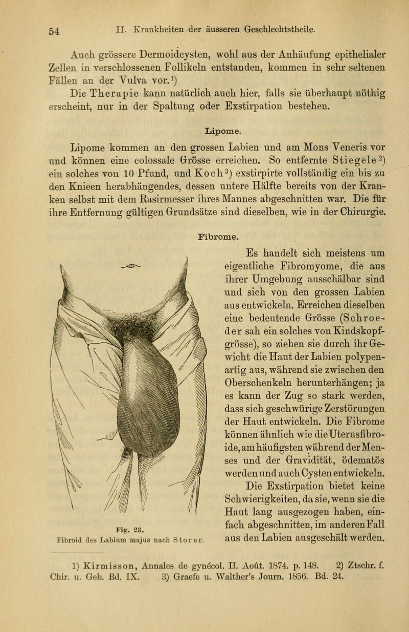 Auch grössere Dermoidcysten, wohl aus der Anhäufung epithelialer Zellen in verschlossenen Follikeln entstanden, kommen in sehr seltenen Fällen an der Vulva vor.') Die Therapie kann natürlich auch hier, falls sie überhaupt nöthig erscheiat, nur in der Spaltung oder Exstirpation bestehen. Lipome. Lipome kommen an den grossen Labien und am Mons Veneris vor und können eine colossale Grösse erreichen. So entfernte Stiegele^) ein solches von 10 Pfund, und Koch^j exstirpirte vollständig ein bis zu den Knieen herabhängendes, dessen untere Hälfte bereits von der Kran- ken selbst mit dem Rasirmesser ihres Mannes abgeschnitten war. Die für ihre Entfernung gültigen Grundsätze sind dieselben, wie in der Chirurgie. Fibrome. Flg. 28. Fibroid des Labium majus nach Storei. Es handelt sich meistens um eigentliche Fibromyome, die aus ihrer Umgebung ausschälbar sind und sich von den grossen Labien aus entwickeln. Erreichen dieselben eine bedeutende Grösse (Schroe- der sah ein solches von Kindskopf- grösse), so ziehen sie durch ihr Ge- wicht die Haut der Labien polypen- artig aus, während sie zwischen den Oberschenkeln herunterhängen; ja es kann der Zug so stark werden, dass sich geschwürige Zerstörungen der Haut entwickeln. Die Fibrome können ähnlich wie dieUterusfibro- ide, am häufigsten während der Men- ses und der Gravidität, ödematös werden und auch Cysten entwickeln. Die Exstirpation bietet keine Schwierigkeiten, da sie, wenn sie die Haut lang ausgezogen haben, ein- fach abgeschnitten, im anderen Fall aus den Labien ausgeschält werden» 1) Kirmisson, Annales de gynöcol. IL Aoüt. 1874. p. 148. 2) Ztschr. f. Chir. u. Geb. Bd. IX. 3) Graefe u. Walther's Journ. 1856. Bd. 24.