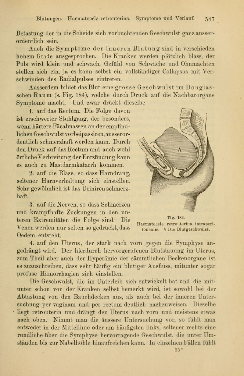 Betastung der in die Scheide sich vorbuchtenden Geschwulst ganz ausser- ordentlich sein. Auch die Symptome der inneren Blutung sind in verschieden hohem Grade ausgesprochen. Die Kranken werden plötzlich blass, der Puls wird klein und schwach, Gefühl von Schwäche und Ohnmächten stellen sich ein, ja es kann selbst ein vollständiger CoUapsus mit Ver- schwinden des Radialpulses eintreten. Ausserdem bildet das Blut eine grosse Geschwulst im Douglas- schen Raum (s. Fig. 184), welche durch Druck auf die Nachbarorgane Symptome macht. Und zwar drückt dieselbe 1. auf das Rectum. Die Folge davon ist erschwerter Stuhlgang, der besonders, wenn härtere Fäcalmassen an der empfind- lichen Geschwulst vorbeipassiren, ausseror- dentlich schmerzhaft werden kann. Durch den Druck auf das Rectum und auch wohl örtliche Verbreitung der Entzündung kann es auch zu Mastdarmkatarrh kommen. 2. auf die Blase, so dass Harndrang, seltener Harnverhaltung sich einstellen. Sehr gewöhnlich ist das Uriniren schmerz- haft. 3. auf die Nerven, so dass Schmerzen und krampfhafte Zuckungen in den un- teren Extremitäten die Folge sind. Die Venen werden nur selten so gedrückt, dass Oedem entsteht. 4. auf den Uterus, der stark nach vorn gegen die Symphyse an- gedrängt wird. Der hierdurch hervorgerufenen Blutstauung im Uterus, zum Theil aber auch der Hyperämie der sämmfliehen Beckenorgane ist es zuzuschreiben, dass sehr häufig ein blutiger Ausfluss, mitunter sogar profuse Hämorrhagien sich einstellen. Die Geschwulst, die im Unterleib sich entwickelt hat und die mit- unter schon von der Kranken selbst bemerkt wird, ist sowohl bei der Abtastung von den Bauchdecken aus, als auch bei der inneren Unter- suchung per vagiuam und per rectum deutlich nachzuweisen. Dieselbe liegt retrouterin und drängt den Uterus nach vorn und meistens etwas nach oben. Nimmt man die äussere Untersuchung vor, so fühlt man entweder in der Mittellinie oder am häufigsten links, seltener rechts eine rundliche über die Symphyse hervorragende Geschwulst, die unter Um- ständen bis zur Nabelhöhle liiuaufreichen kann. In einzelnen Fällen fühlt 35* Fig. 184. Haematocele retrouterina intraperi- tonealis. h Die Blutgeschwulst.